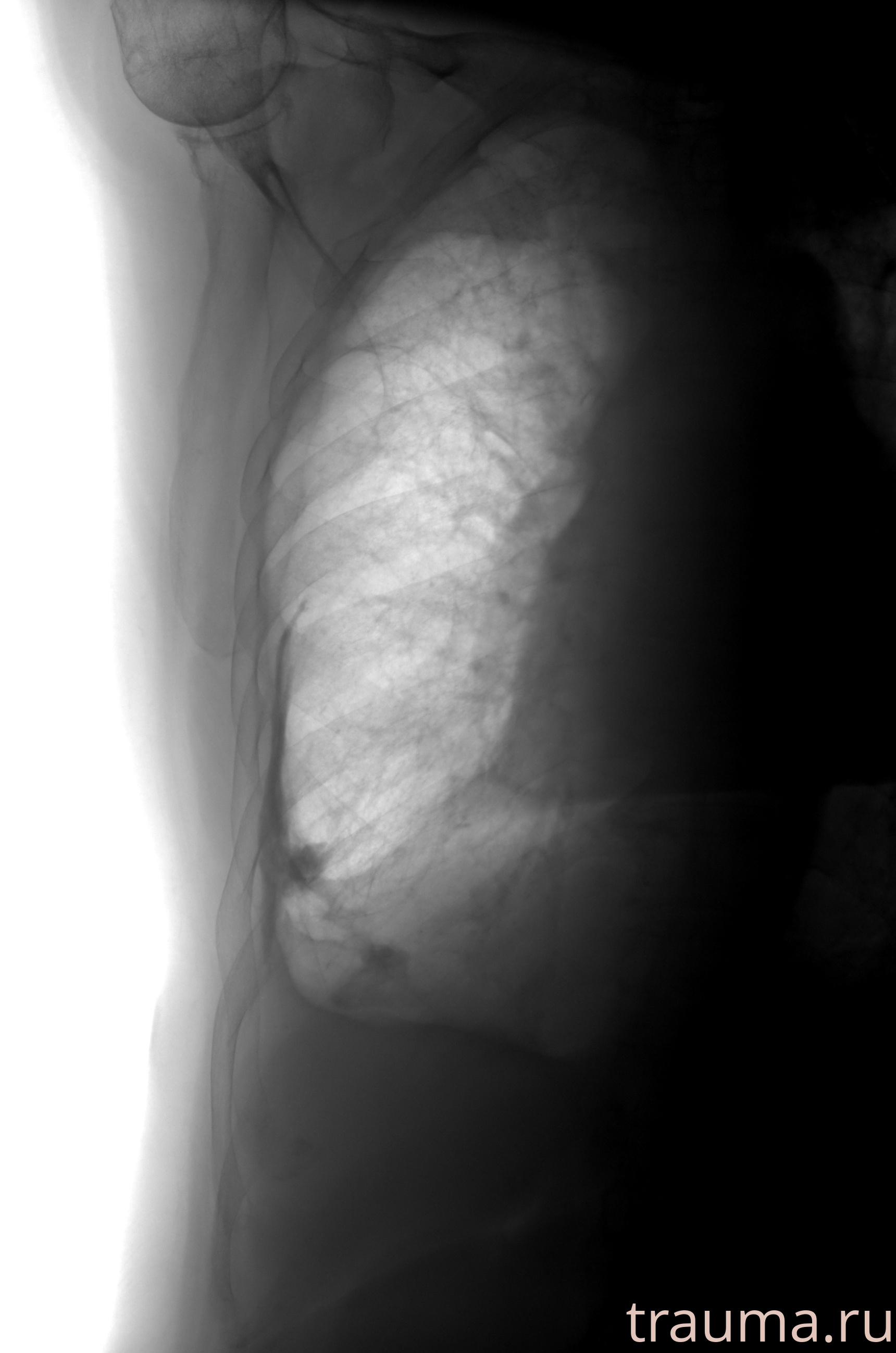 Рентген на дому: по вашему адресу приезжает врач-рентгенолог, травматолог-ортопед с мобильным рентгеновским аппаратом, проводит диагностику травмы или заболевания, делает необходимые рентгенограммы, дает рекомендации по дальнейшему лечению. Получить качественные снимки в домашних условиях возможно благодаря уникальной методике, разработанной МосРентген Центром для института  Склифосовского