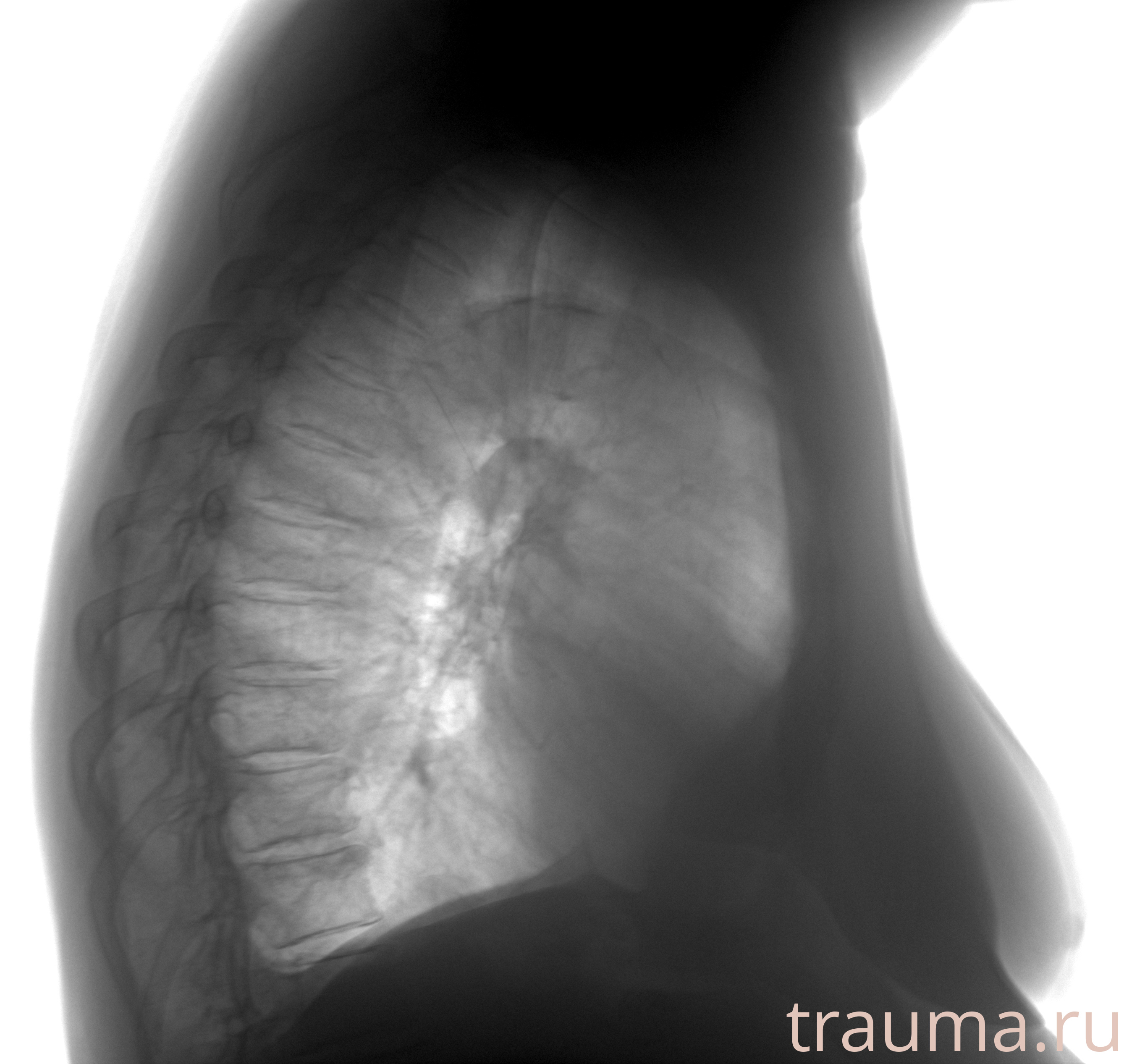 Рентген на дому: по вашему адресу приезжает врач-рентгенолог, травматолог-ортопед с мобильным рентгеновским аппаратом, проводит диагностику травмы или заболевания, делает необходимые рентгенограммы, дает рекомендации по дальнейшему лечению. Получить качественные снимки в домашних условиях возможно благодаря уникальной методике, разработанной МосРентген Центром для института  Склифосовского