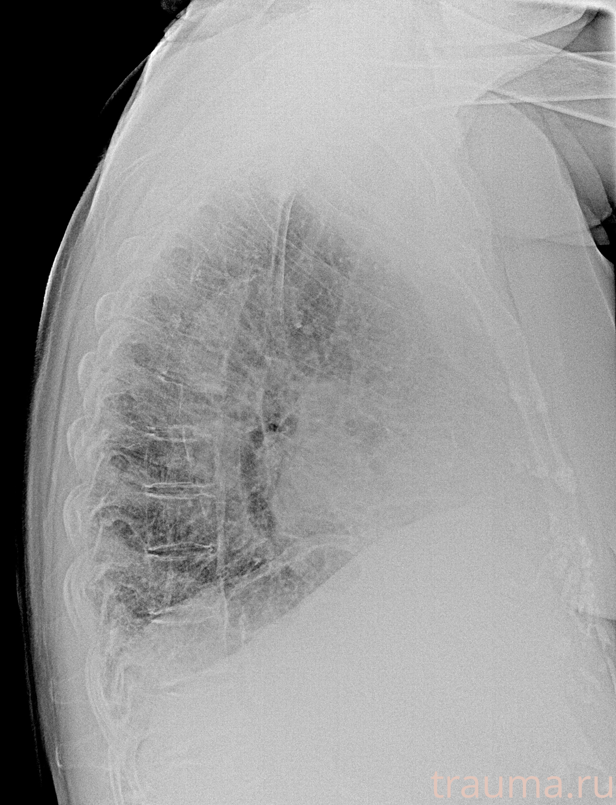 Рентген на дому: по вашему адресу приезжает врач-рентгенолог, травматолог-ортопед с мобильным рентгеновским аппаратом, проводит диагностику травмы или заболевания, делает необходимые рентгенограммы, дает рекомендации по дальнейшему лечению. Получить качественные снимки в домашних условиях возможно благодаря уникальной методике, разработанной МосРентген Центром для института  Склифосовского