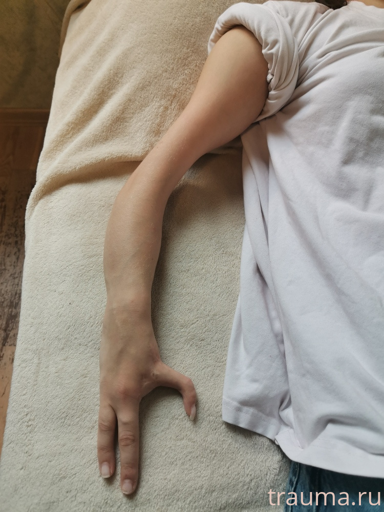 Рентген на дому: по вашему адресу приезжает врач-рентгенолог, травматолог-ортопед с мобильным рентгеновским аппаратом, проводит диагностику травмы или заболевания, делает необходимые рентгенограммы, дает рекомендации по дальнейшему лечению. Получить качественные снимки в домашних условиях возможно благодаря уникальной методике, разработанной МосРентген Центром для института  Склифосовского