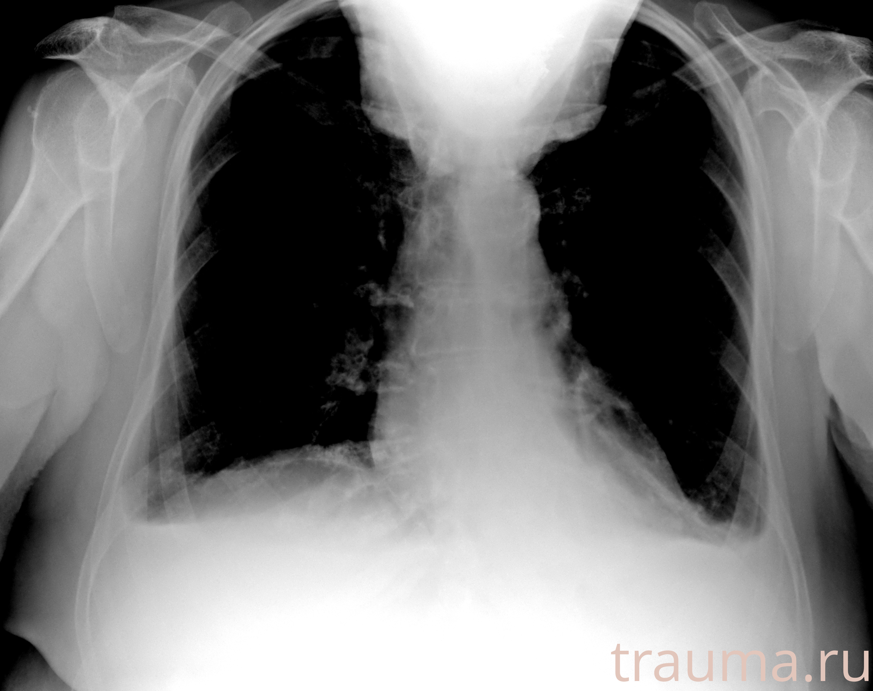 Рентген на дому: по вашему адресу приезжает врач-рентгенолог, травматолог-ортопед с мобильным рентгеновским аппаратом, проводит диагностику травмы или заболевания, делает необходимые рентгенограммы, дает рекомендации по дальнейшему лечению. Получить качественные снимки в домашних условиях возможно благодаря уникальной методике, разработанной МосРентген Центром для института  Склифосовского