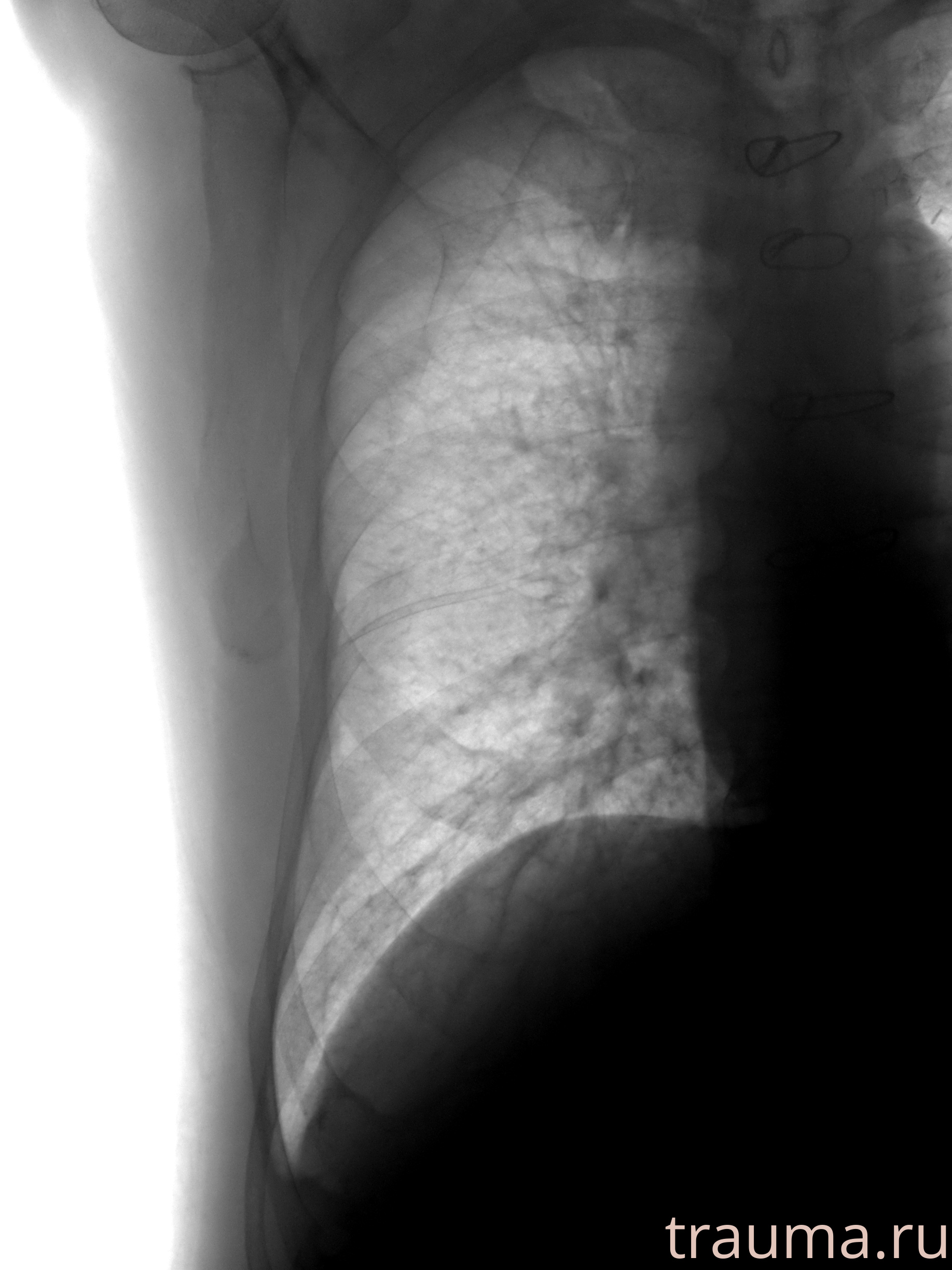 Рентген на дому: по вашему адресу приезжает врач-рентгенолог, травматолог-ортопед с мобильным рентгеновским аппаратом, проводит диагностику травмы или заболевания, делает необходимые рентгенограммы, дает рекомендации по дальнейшему лечению. Получить качественные снимки в домашних условиях возможно благодаря уникальной методике, разработанной МосРентген Центром для института  Склифосовского