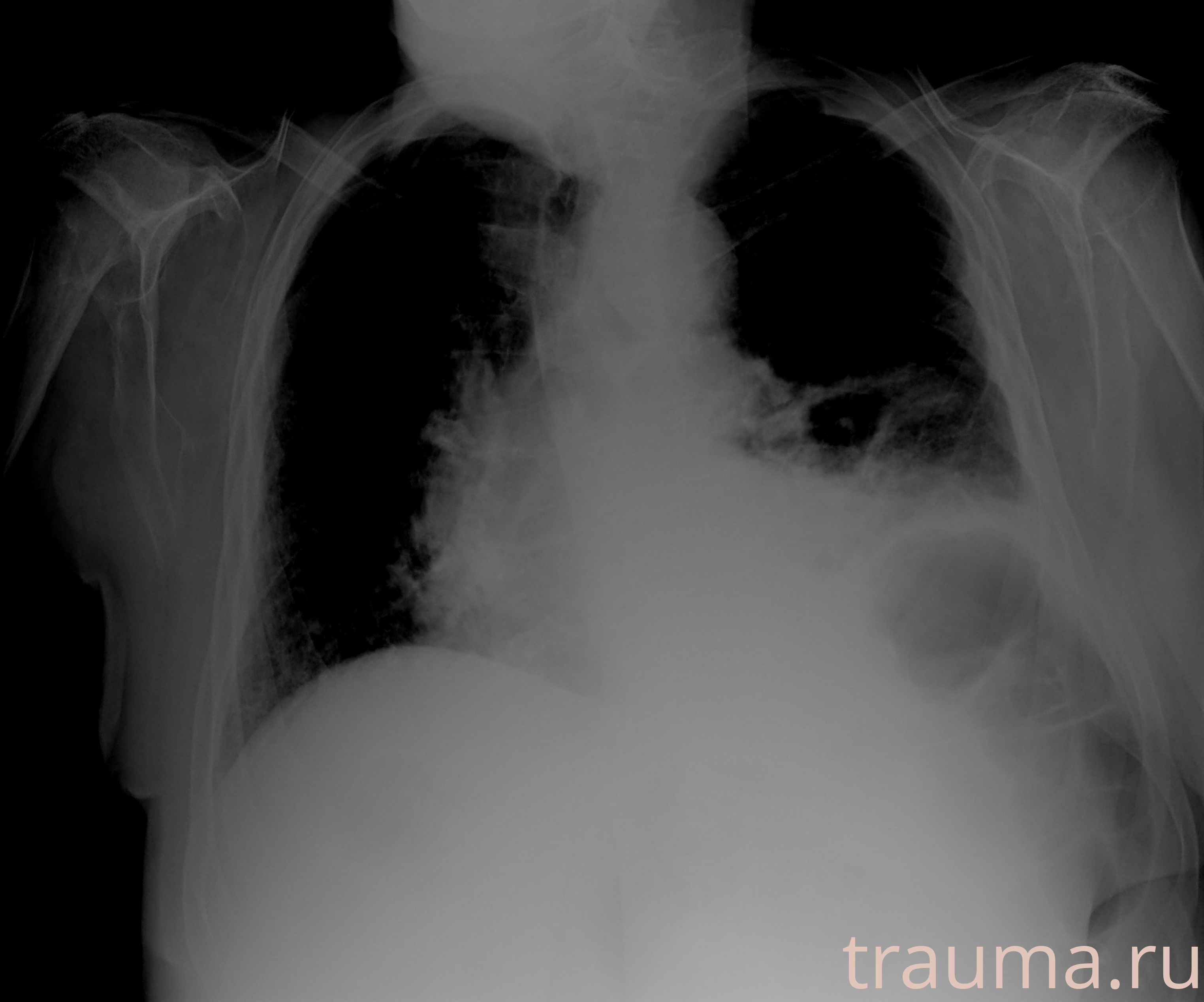 Рентген на дому: по вашему адресу приезжает врач-рентгенолог, травматолог-ортопед с мобильным рентгеновским аппаратом, проводит диагностику травмы или заболевания, делает необходимые рентгенограммы, дает рекомендации по дальнейшему лечению. Получить качественные снимки в домашних условиях возможно благодаря уникальной методике, разработанной МосРентген Центром для института  Склифосовского