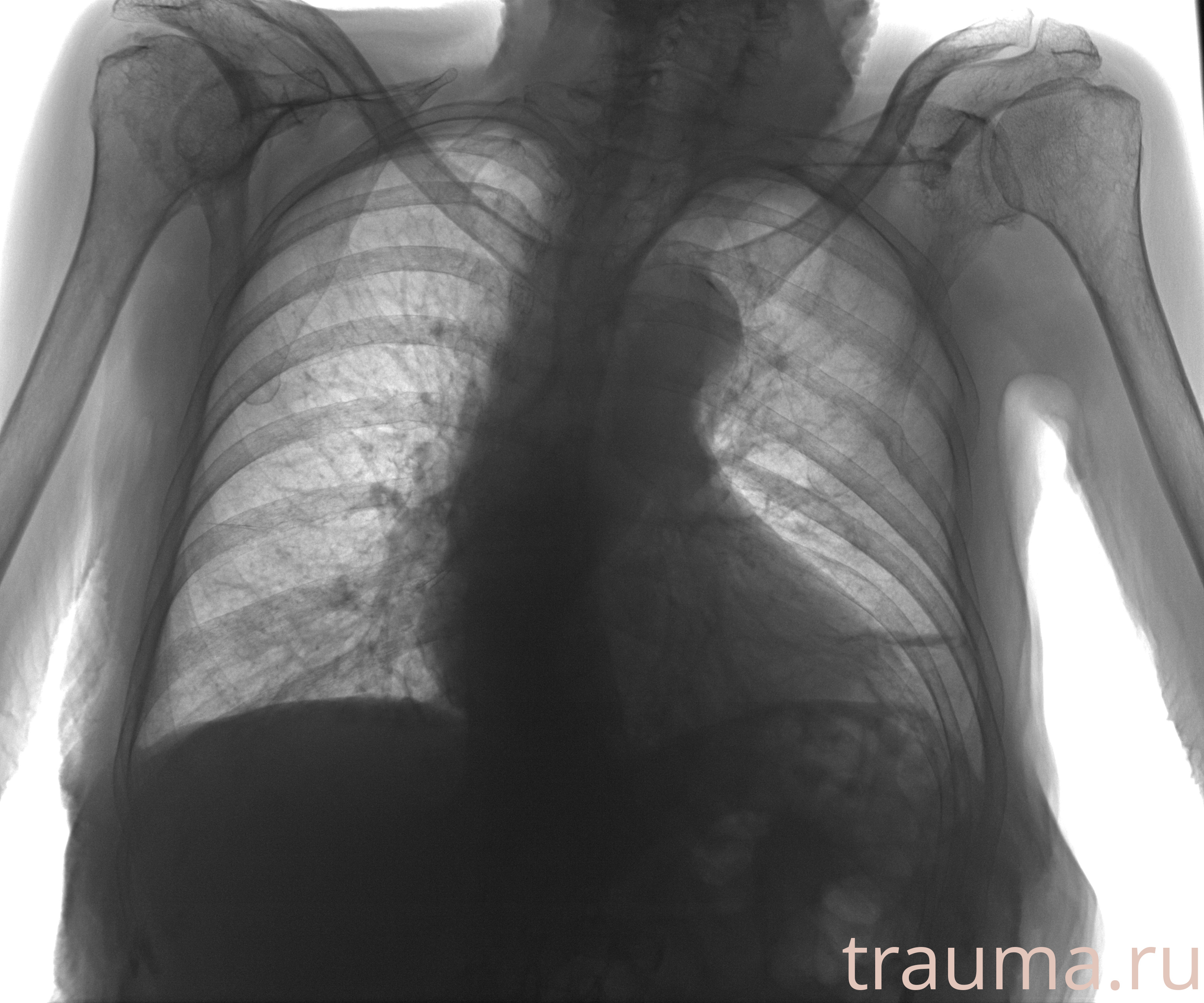 Рентген на дому: по вашему адресу приезжает врач-рентгенолог, травматолог-ортопед с мобильным рентгеновским аппаратом, проводит диагностику травмы или заболевания, делает необходимые рентгенограммы, дает рекомендации по дальнейшему лечению. Получить качественные снимки в домашних условиях возможно благодаря уникальной методике, разработанной МосРентген Центром для института  Склифосовского