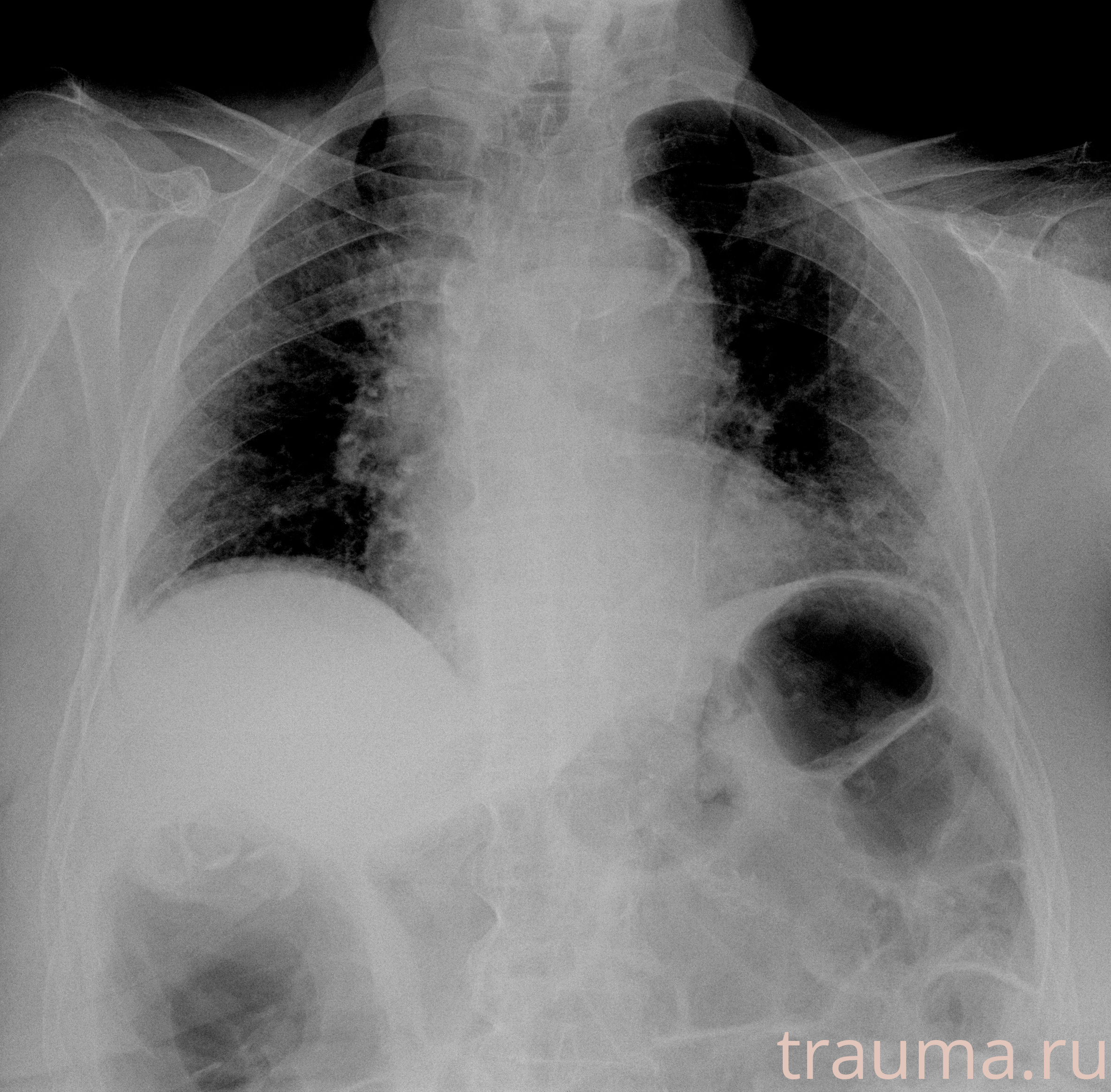 Рентген на дому: по вашему адресу приезжает врач-рентгенолог, травматолог-ортопед с мобильным рентгеновским аппаратом, проводит диагностику травмы или заболевания, делает необходимые рентгенограммы, дает рекомендации по дальнейшему лечению. Получить качественные снимки в домашних условиях возможно благодаря уникальной методике, разработанной МосРентген Центром для института  Склифосовского