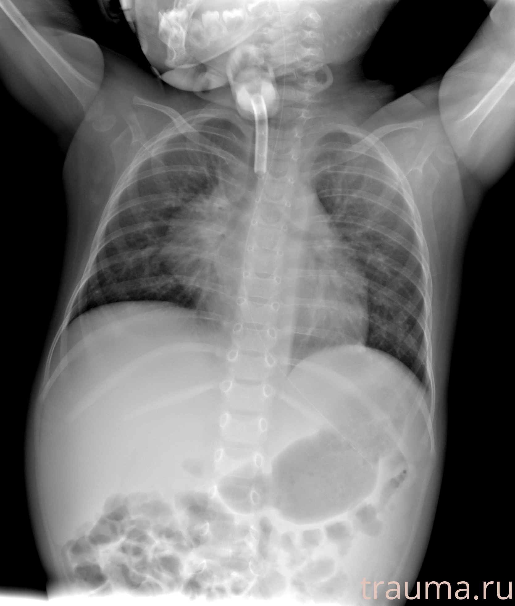 Рентген на дому: по вашему адресу приезжает врач-рентгенолог, травматолог-ортопед с мобильным рентгеновским аппаратом, проводит диагностику травмы или заболевания, делает необходимые рентгенограммы, дает рекомендации по дальнейшему лечению. Получить качественные снимки в домашних условиях возможно благодаря уникальной методике, разработанной МосРентген Центром для института  Склифосовского