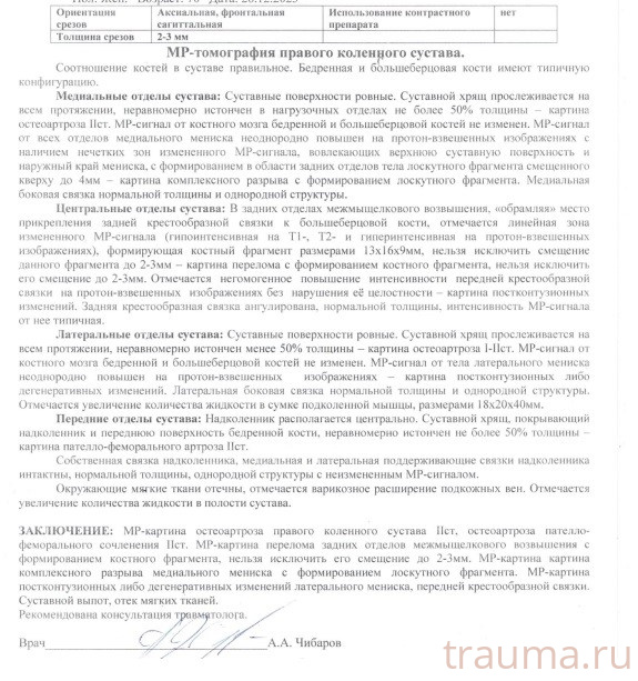 Рентген на дому: по вашему адресу приезжает врач-рентгенолог, травматолог-ортопед с мобильным рентгеновским аппаратом, проводит диагностику травмы или заболевания, делает необходимые рентгенограммы, дает рекомендации по дальнейшему лечению. Получить качественные снимки в домашних условиях возможно благодаря уникальной методике, разработанной МосРентген Центром для института  Склифосовского
