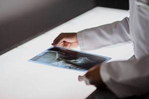 Качество рентгенограмм и компоненты фотопроцесса Качество рентгенограмм и компоненты фотопроцесса