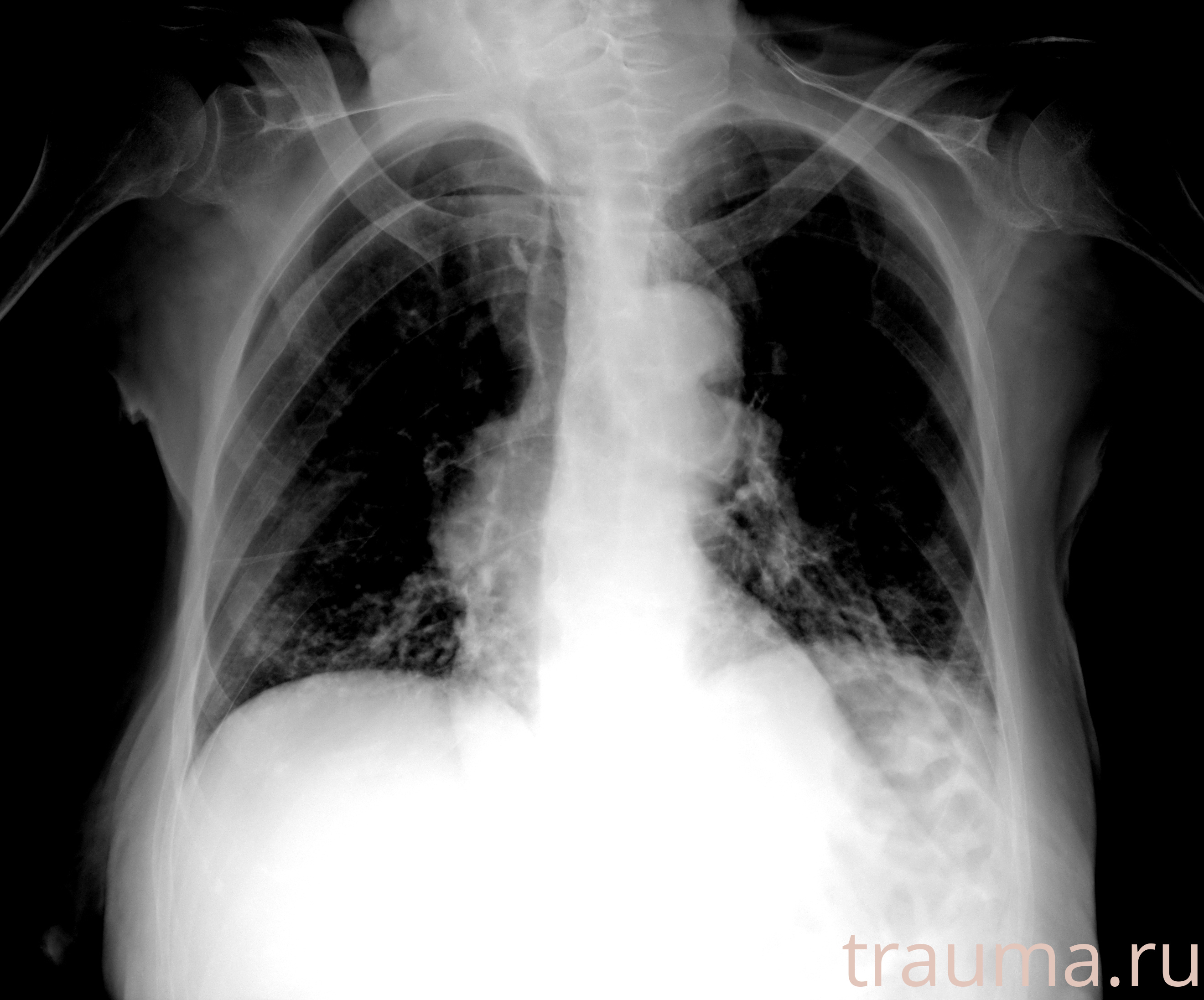 Рентген на дому: по вашему адресу приезжает врач-рентгенолог, травматолог-ортопед с мобильным рентгеновским аппаратом, проводит диагностику травмы или заболевания, делает необходимые рентгенограммы, дает рекомендации по дальнейшему лечению. Получить качественные снимки в домашних условиях возможно благодаря уникальной методике, разработанной МосРентген Центром для института  Склифосовского