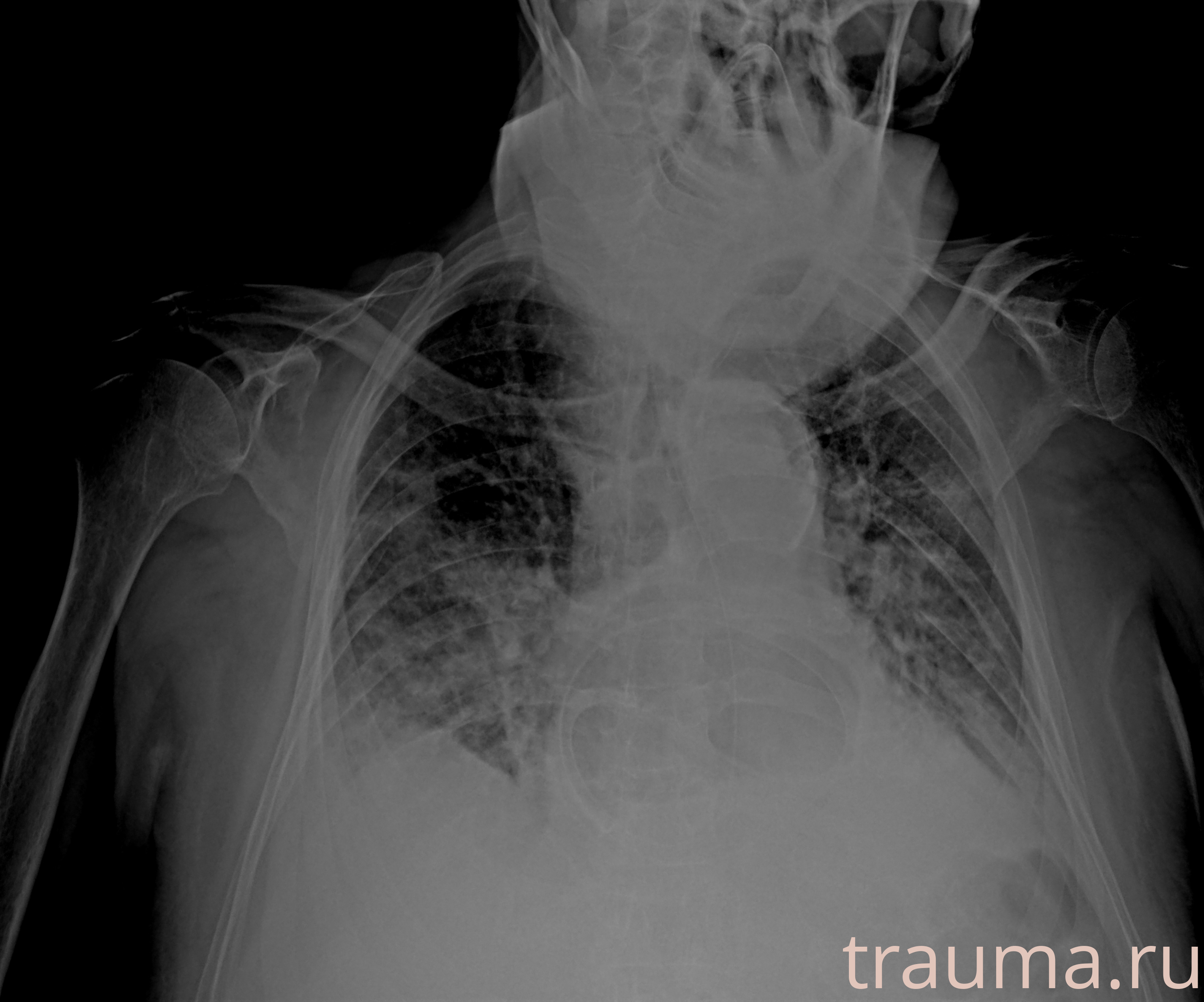 Рентген на дому: по вашему адресу приезжает врач-рентгенолог, травматолог-ортопед с мобильным рентгеновским аппаратом, проводит диагностику травмы или заболевания, делает необходимые рентгенограммы, дает рекомендации по дальнейшему лечению. Получить качественные снимки в домашних условиях возможно благодаря уникальной методике, разработанной МосРентген Центром для института  Склифосовского