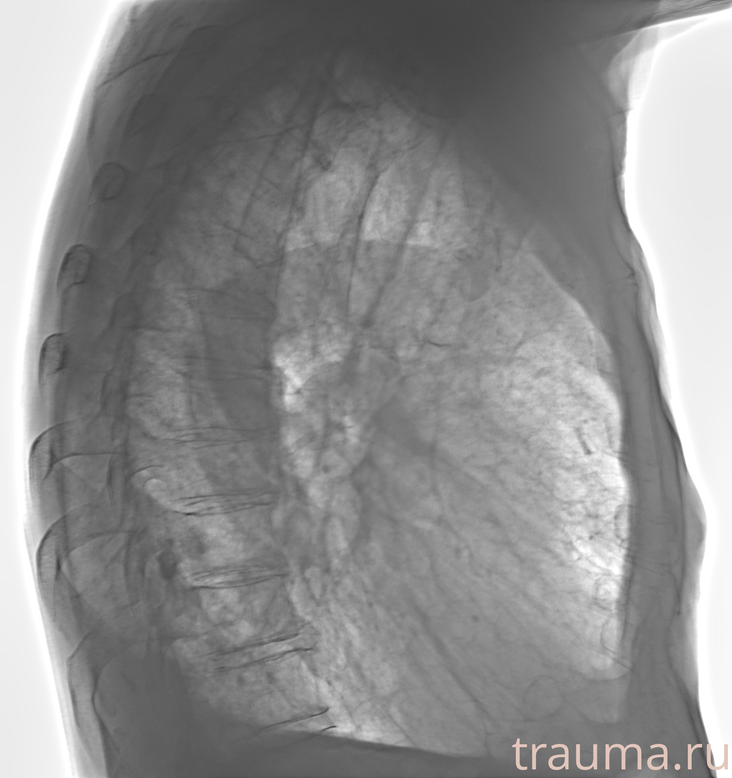 Рентген на дому: по вашему адресу приезжает врач-рентгенолог, травматолог-ортопед с мобильным рентгеновским аппаратом, проводит диагностику травмы или заболевания, делает необходимые рентгенограммы, дает рекомендации по дальнейшему лечению. Получить качественные снимки в домашних условиях возможно благодаря уникальной методике, разработанной МосРентген Центром для института  Склифосовского