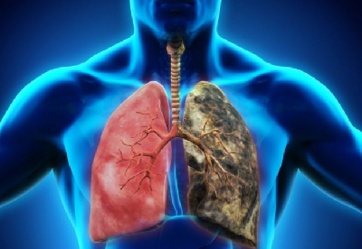 Проблемы с легкими