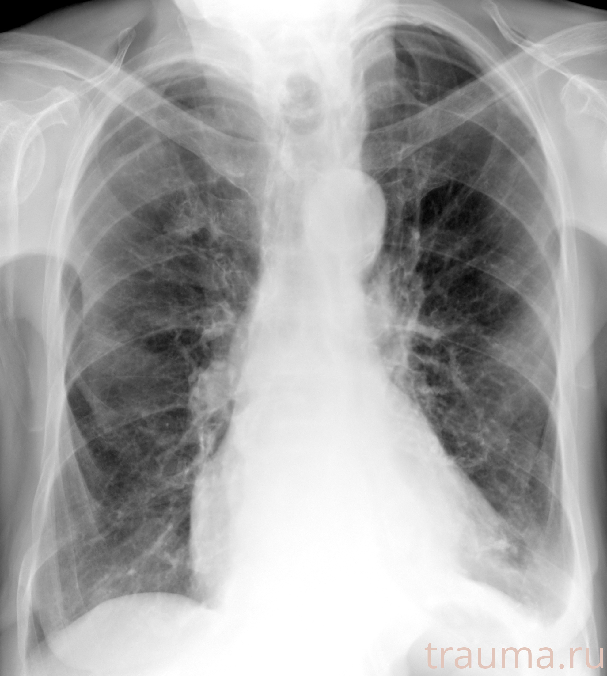 Рентген на дому: по вашему адресу приезжает врач-рентгенолог, травматолог-ортопед с мобильным рентгеновским аппаратом, проводит диагностику травмы или заболевания, делает необходимые рентгенограммы, дает рекомендации по дальнейшему лечению. Получить качественные снимки в домашних условиях возможно благодаря уникальной методике, разработанной МосРентген Центром для института  Склифосовского