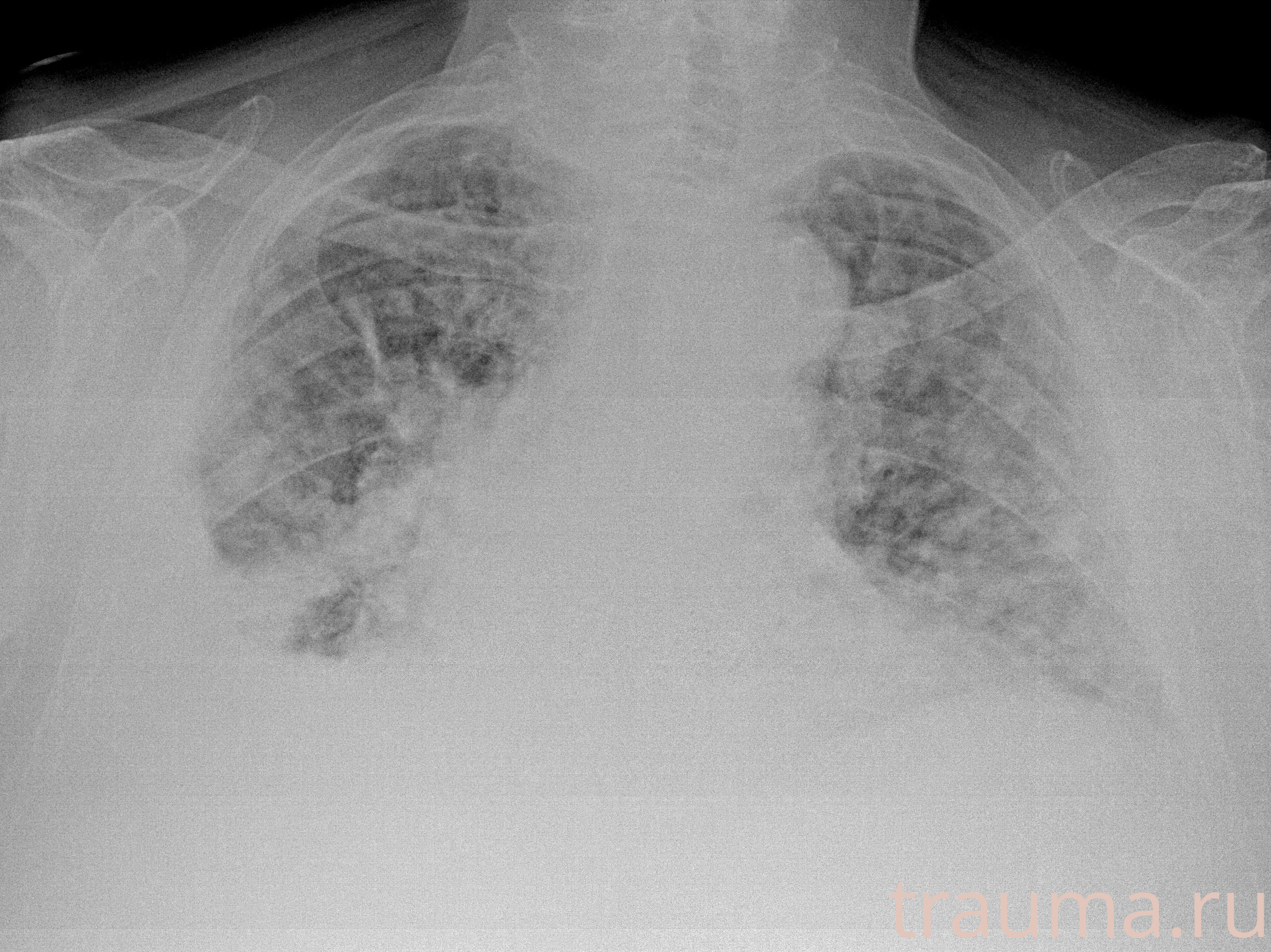 Рентген на дому: по вашему адресу приезжает врач-рентгенолог, травматолог-ортопед с мобильным рентгеновским аппаратом, проводит диагностику травмы или заболевания, делает необходимые рентгенограммы, дает рекомендации по дальнейшему лечению. Получить качественные снимки в домашних условиях возможно благодаря уникальной методике, разработанной МосРентген Центром для института  Склифосовского