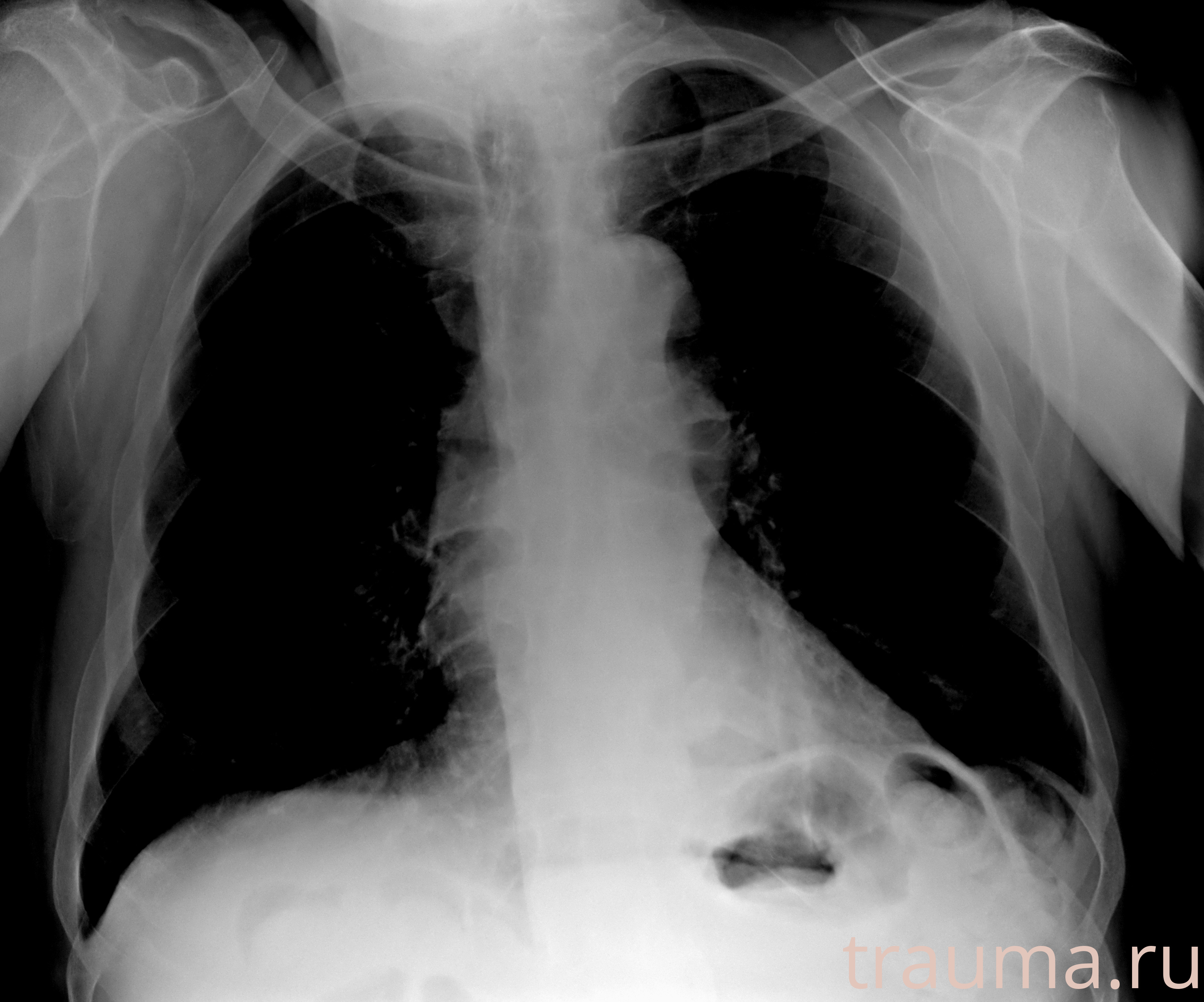 Рентген на дому: по вашему адресу приезжает врач-рентгенолог, травматолог-ортопед с мобильным рентгеновским аппаратом, проводит диагностику травмы или заболевания, делает необходимые рентгенограммы, дает рекомендации по дальнейшему лечению. Получить качественные снимки в домашних условиях возможно благодаря уникальной методике, разработанной МосРентген Центром для института  Склифосовского