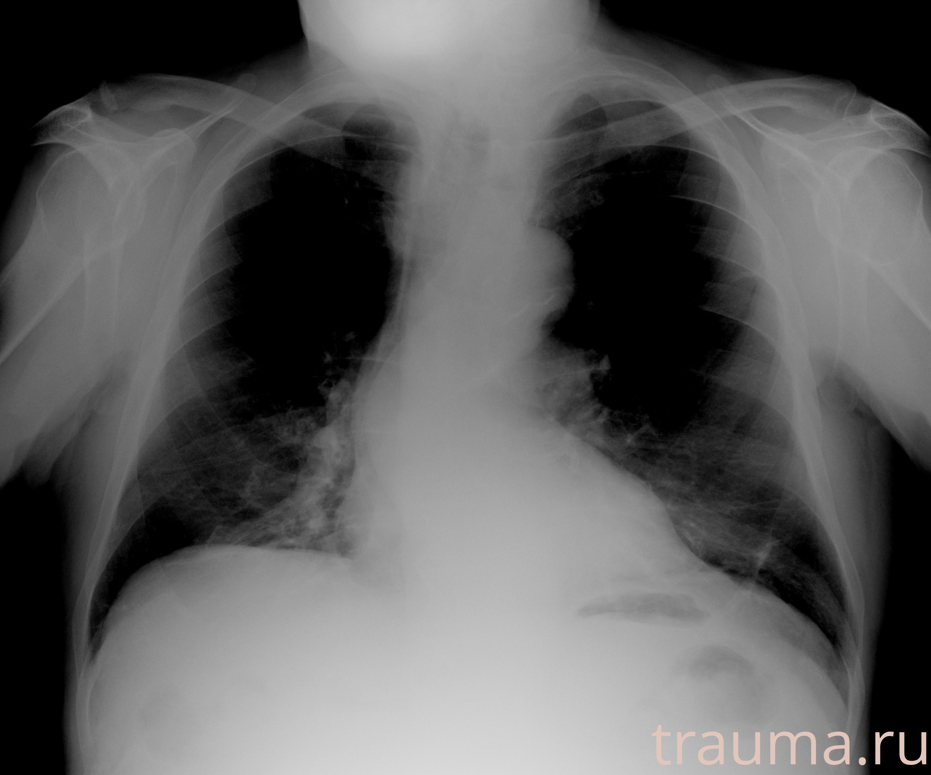 Рентген на дому: по вашему адресу приезжает врач-рентгенолог, травматолог-ортопед с мобильным рентгеновским аппаратом, проводит диагностику травмы или заболевания, делает необходимые рентгенограммы, дает рекомендации по дальнейшему лечению. Получить качественные снимки в домашних условиях возможно благодаря уникальной методике, разработанной МосРентген Центром для института  Склифосовского