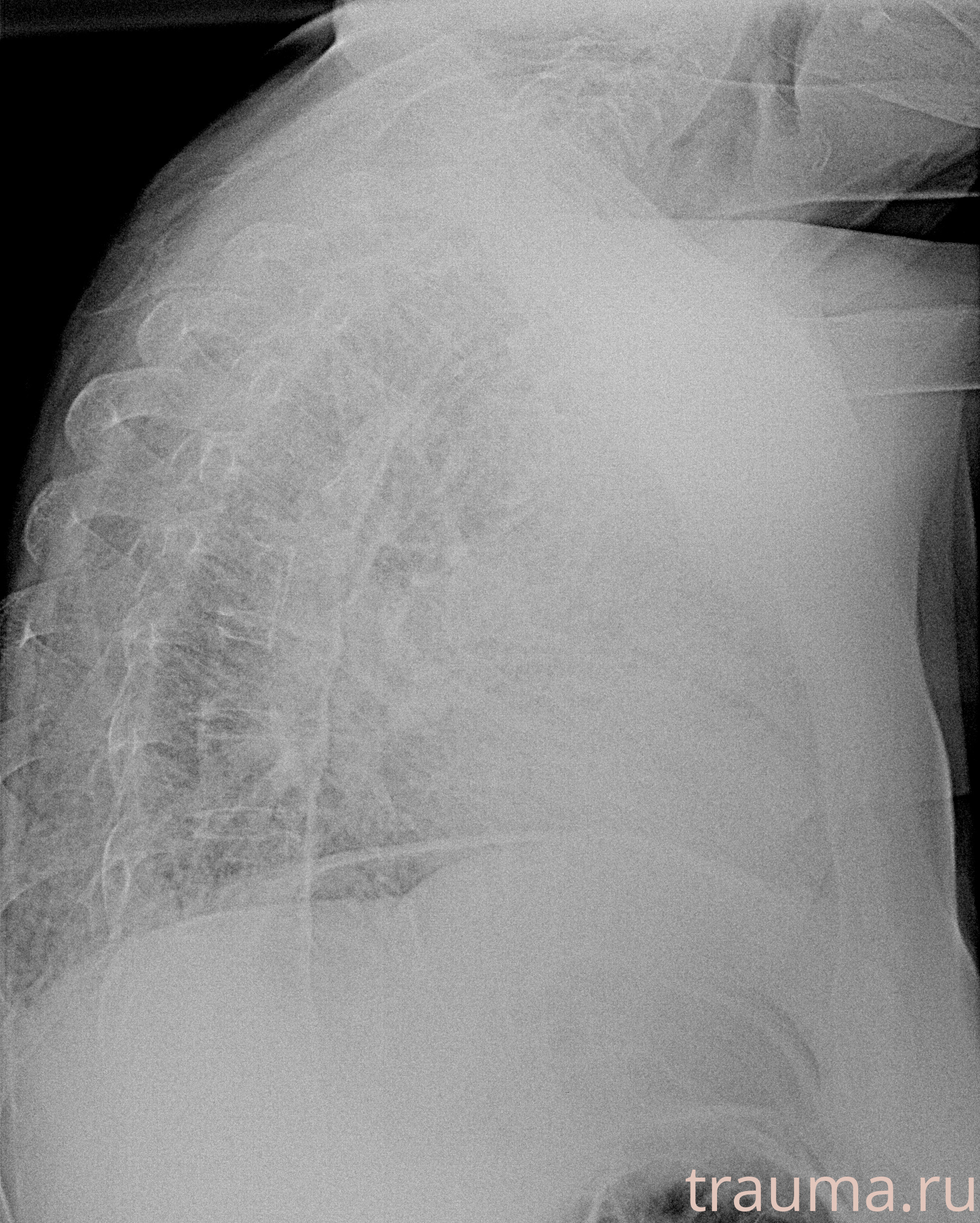 Рентген на дому: по вашему адресу приезжает врач-рентгенолог, травматолог-ортопед с мобильным рентгеновским аппаратом, проводит диагностику травмы или заболевания, делает необходимые рентгенограммы, дает рекомендации по дальнейшему лечению. Получить качественные снимки в домашних условиях возможно благодаря уникальной методике, разработанной МосРентген Центром для института  Склифосовского