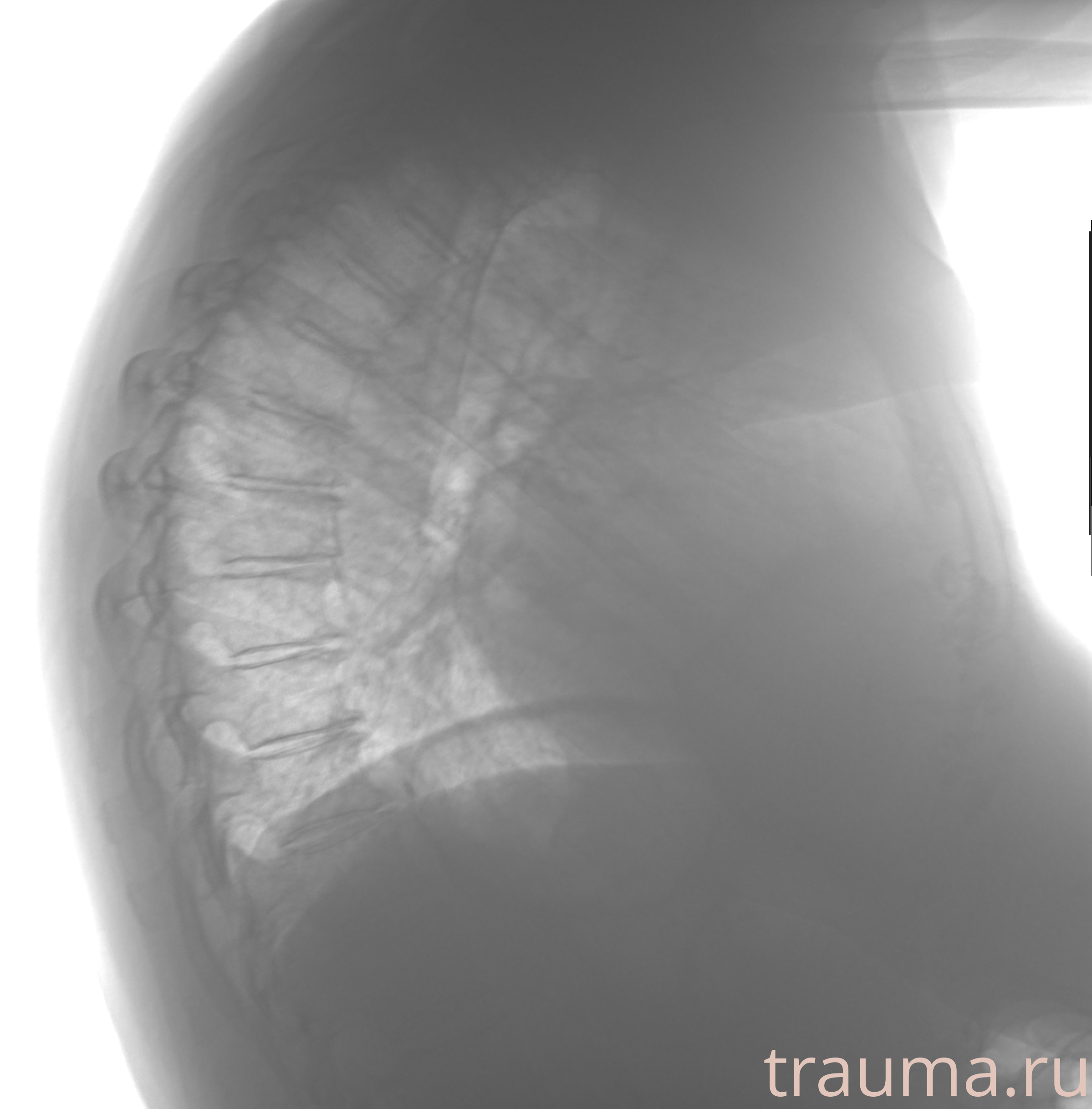 Рентген на дому: по вашему адресу приезжает врач-рентгенолог, травматолог-ортопед с мобильным рентгеновским аппаратом, проводит диагностику травмы или заболевания, делает необходимые рентгенограммы, дает рекомендации по дальнейшему лечению. Получить качественные снимки в домашних условиях возможно благодаря уникальной методике, разработанной МосРентген Центром для института  Склифосовского