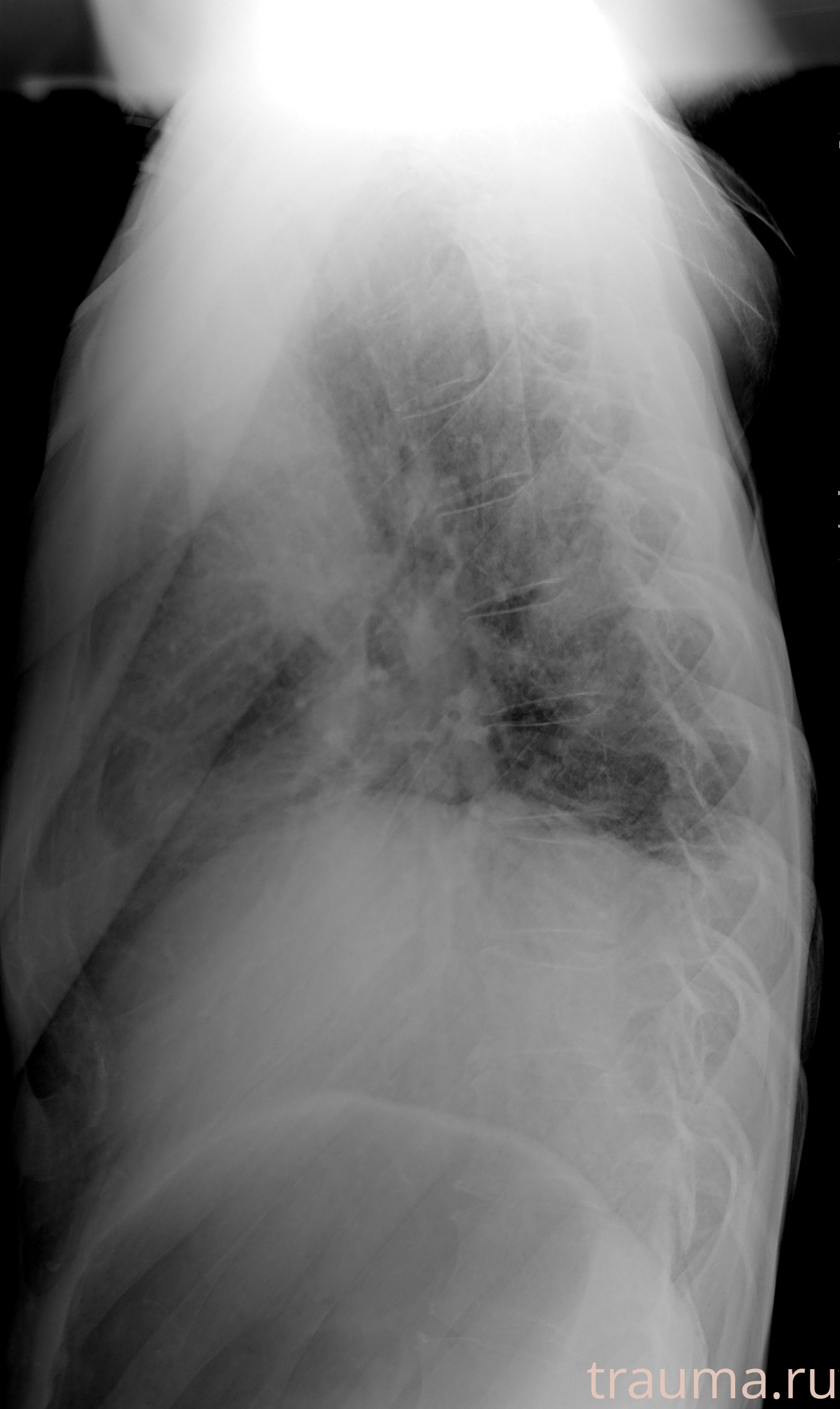 Рентген на дому: по вашему адресу приезжает врач-рентгенолог, травматолог-ортопед с мобильным рентгеновским аппаратом, проводит диагностику травмы или заболевания, делает необходимые рентгенограммы, дает рекомендации по дальнейшему лечению. Получить качественные снимки в домашних условиях возможно благодаря уникальной методике, разработанной МосРентген Центром для института  Склифосовского