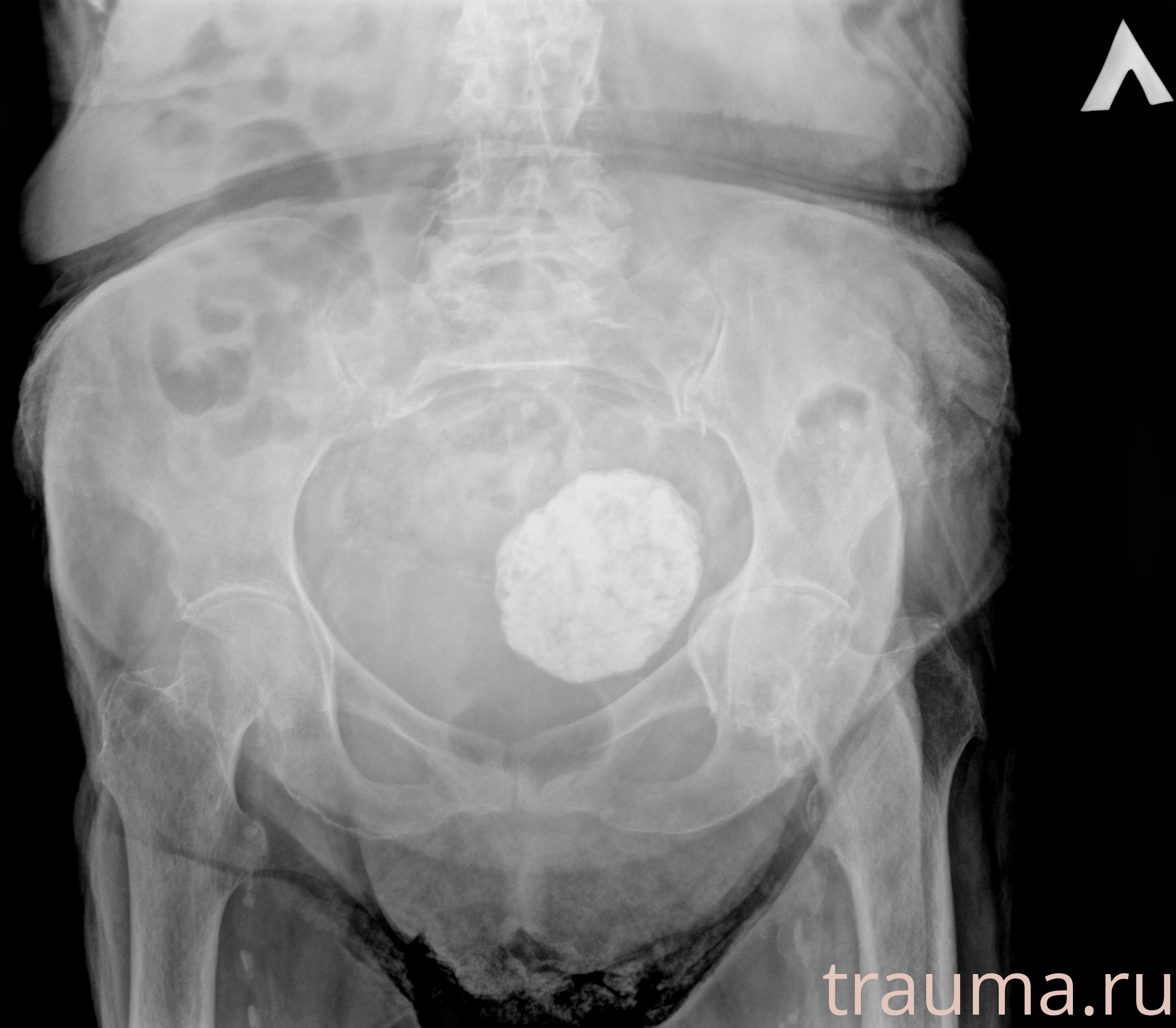 Рентген на дому: по вашему адресу приезжает врач-рентгенолог, травматолог-ортопед с мобильным рентгеновским аппаратом, проводит диагностику травмы или заболевания, делает необходимые рентгенограммы, дает рекомендации по дальнейшему лечению. Получить качественные снимки в домашних условиях возможно благодаря уникальной методике, разработанной МосРентген Центром для института  Склифосовского