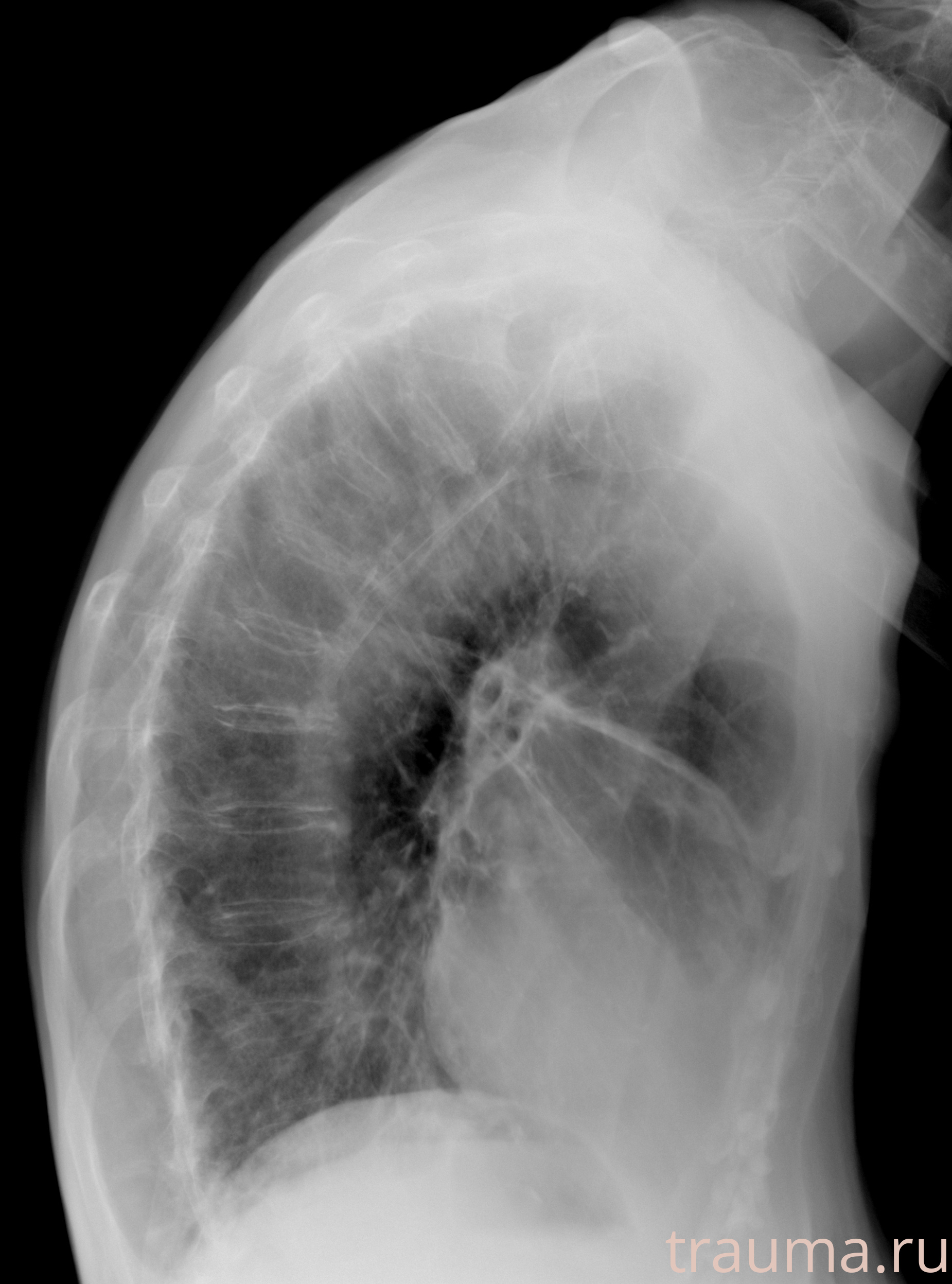 Рентген на дому: по вашему адресу приезжает врач-рентгенолог, травматолог-ортопед с мобильным рентгеновским аппаратом, проводит диагностику травмы или заболевания, делает необходимые рентгенограммы, дает рекомендации по дальнейшему лечению. Получить качественные снимки в домашних условиях возможно благодаря уникальной методике, разработанной МосРентген Центром для института  Склифосовского