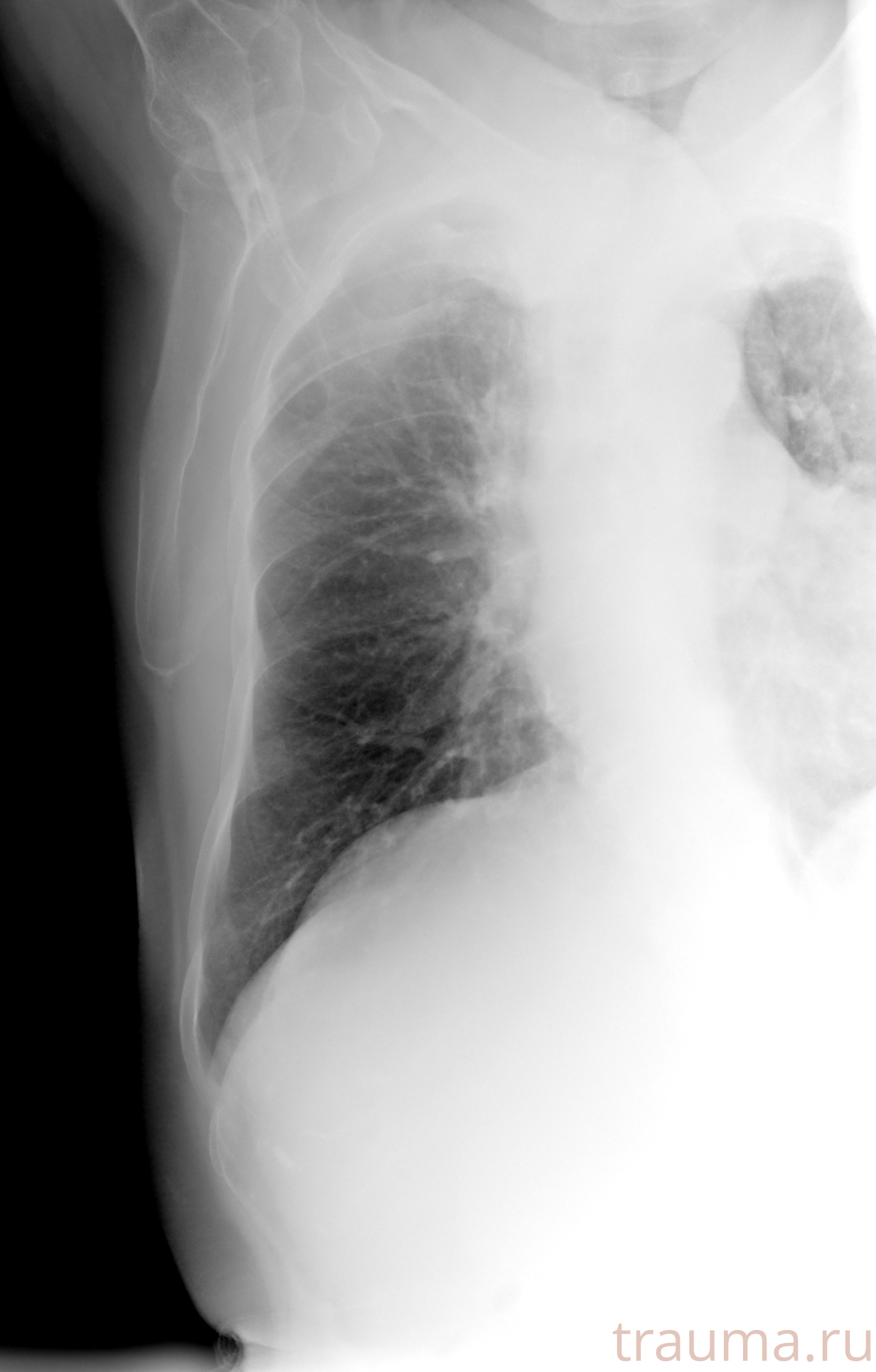 Рентген на дому: по вашему адресу приезжает врач-рентгенолог, травматолог-ортопед с мобильным рентгеновским аппаратом, проводит диагностику травмы или заболевания, делает необходимые рентгенограммы, дает рекомендации по дальнейшему лечению. Получить качественные снимки в домашних условиях возможно благодаря уникальной методике, разработанной МосРентген Центром для института  Склифосовского