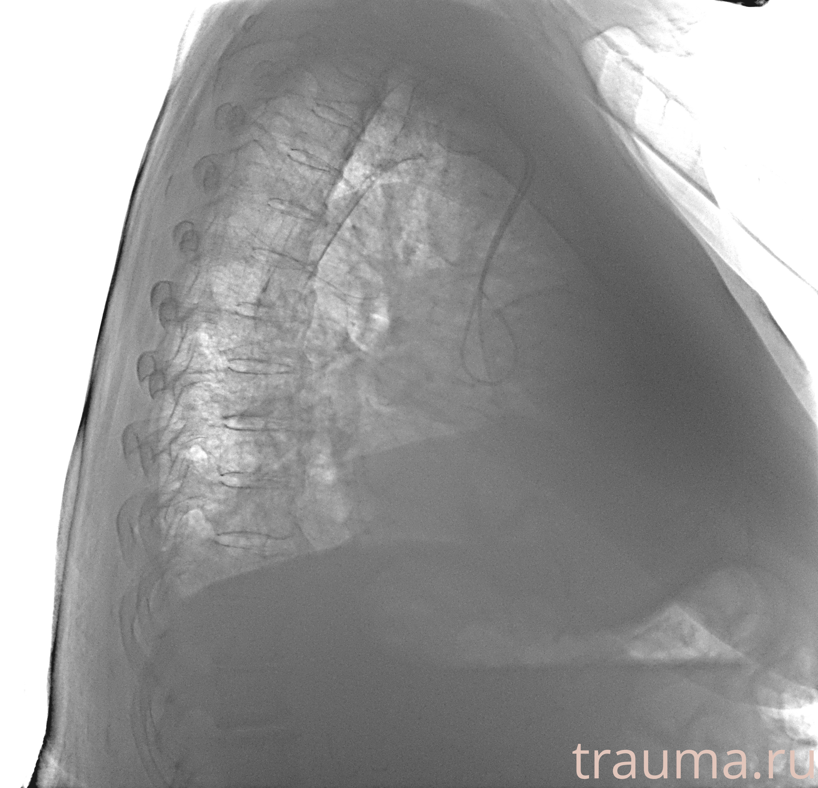 Рентген на дому: по вашему адресу приезжает врач-рентгенолог, травматолог-ортопед с мобильным рентгеновским аппаратом, проводит диагностику травмы или заболевания, делает необходимые рентгенограммы, дает рекомендации по дальнейшему лечению. Получить качественные снимки в домашних условиях возможно благодаря уникальной методике, разработанной МосРентген Центром для института  Склифосовского