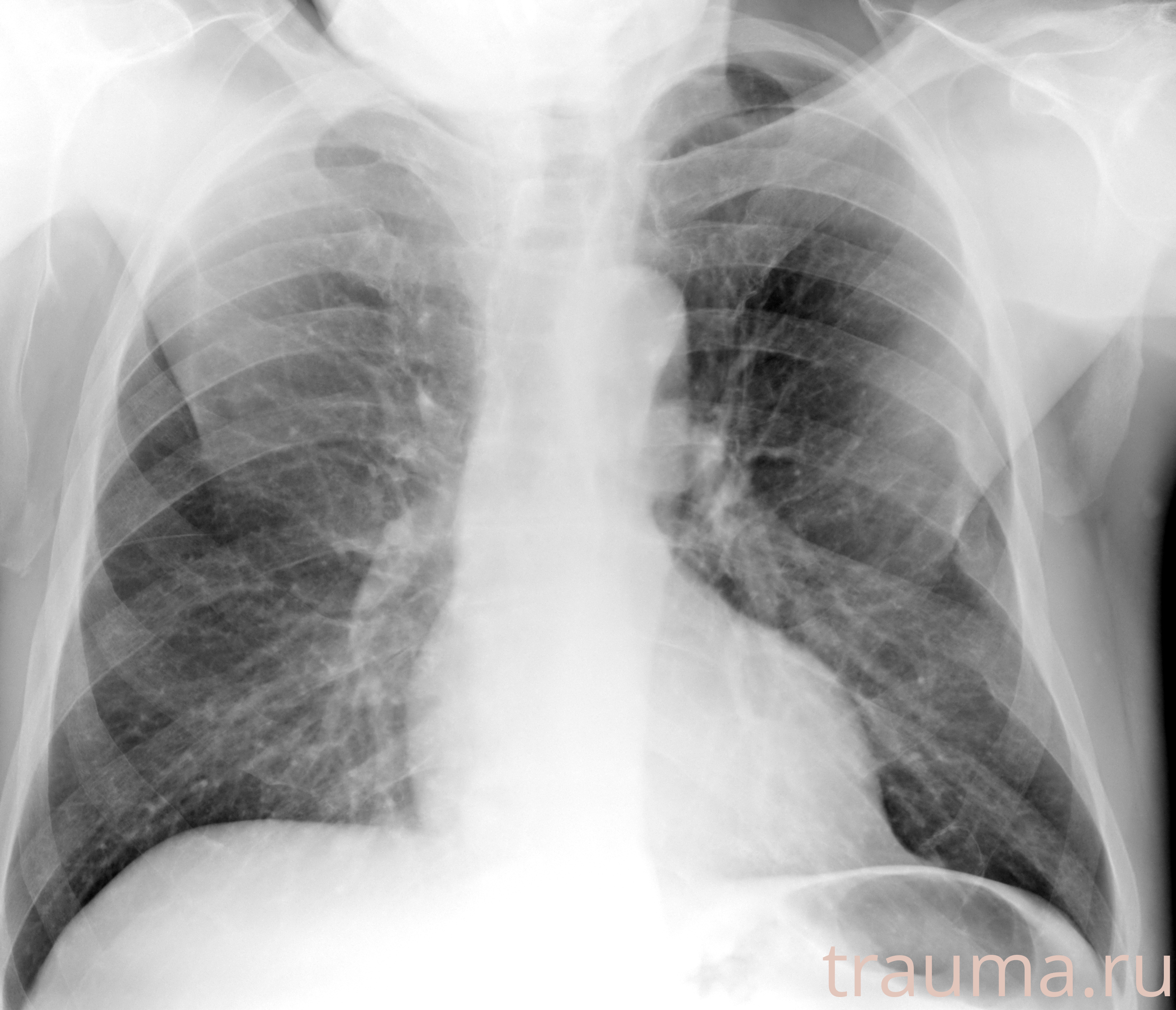 Рентген на дому: по вашему адресу приезжает врач-рентгенолог, травматолог-ортопед с мобильным рентгеновским аппаратом, проводит диагностику травмы или заболевания, делает необходимые рентгенограммы, дает рекомендации по дальнейшему лечению. Получить качественные снимки в домашних условиях возможно благодаря уникальной методике, разработанной МосРентген Центром для института  Склифосовского