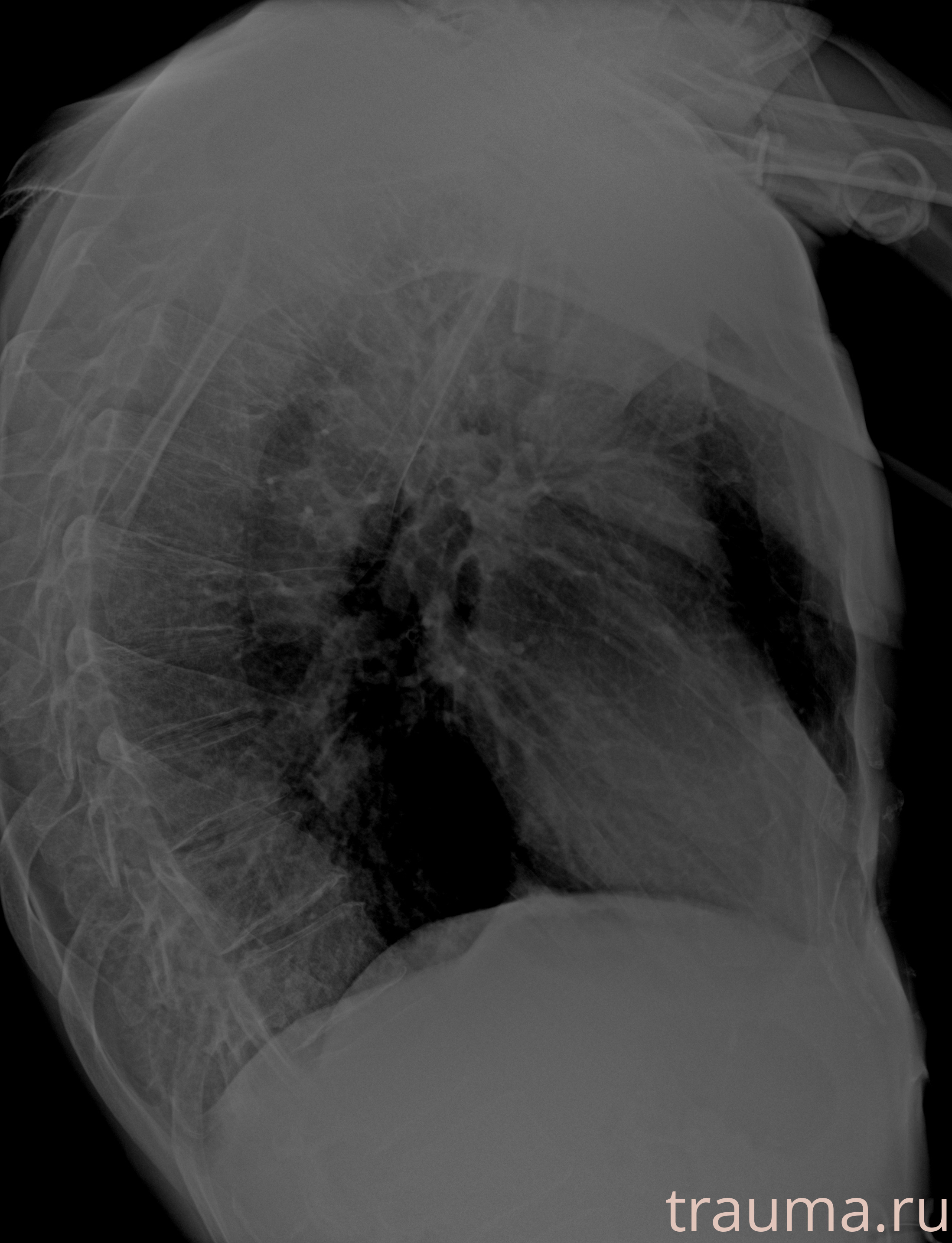 Рентген на дому: по вашему адресу приезжает врач-рентгенолог, травматолог-ортопед с мобильным рентгеновским аппаратом, проводит диагностику травмы или заболевания, делает необходимые рентгенограммы, дает рекомендации по дальнейшему лечению. Получить качественные снимки в домашних условиях возможно благодаря уникальной методике, разработанной МосРентген Центром для института  Склифосовского