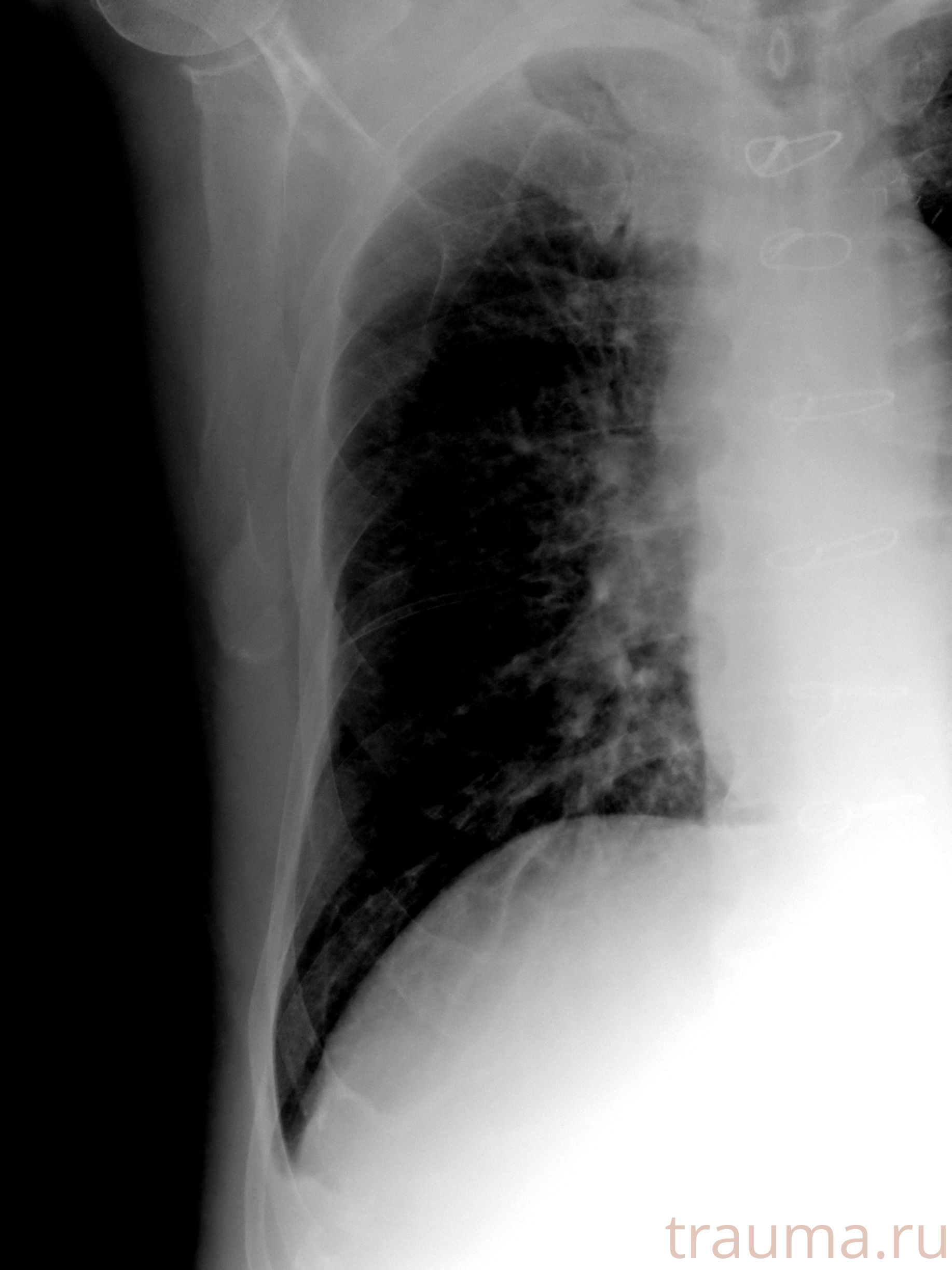 Рентген на дому: по вашему адресу приезжает врач-рентгенолог, травматолог-ортопед с мобильным рентгеновским аппаратом, проводит диагностику травмы или заболевания, делает необходимые рентгенограммы, дает рекомендации по дальнейшему лечению. Получить качественные снимки в домашних условиях возможно благодаря уникальной методике, разработанной МосРентген Центром для института  Склифосовского