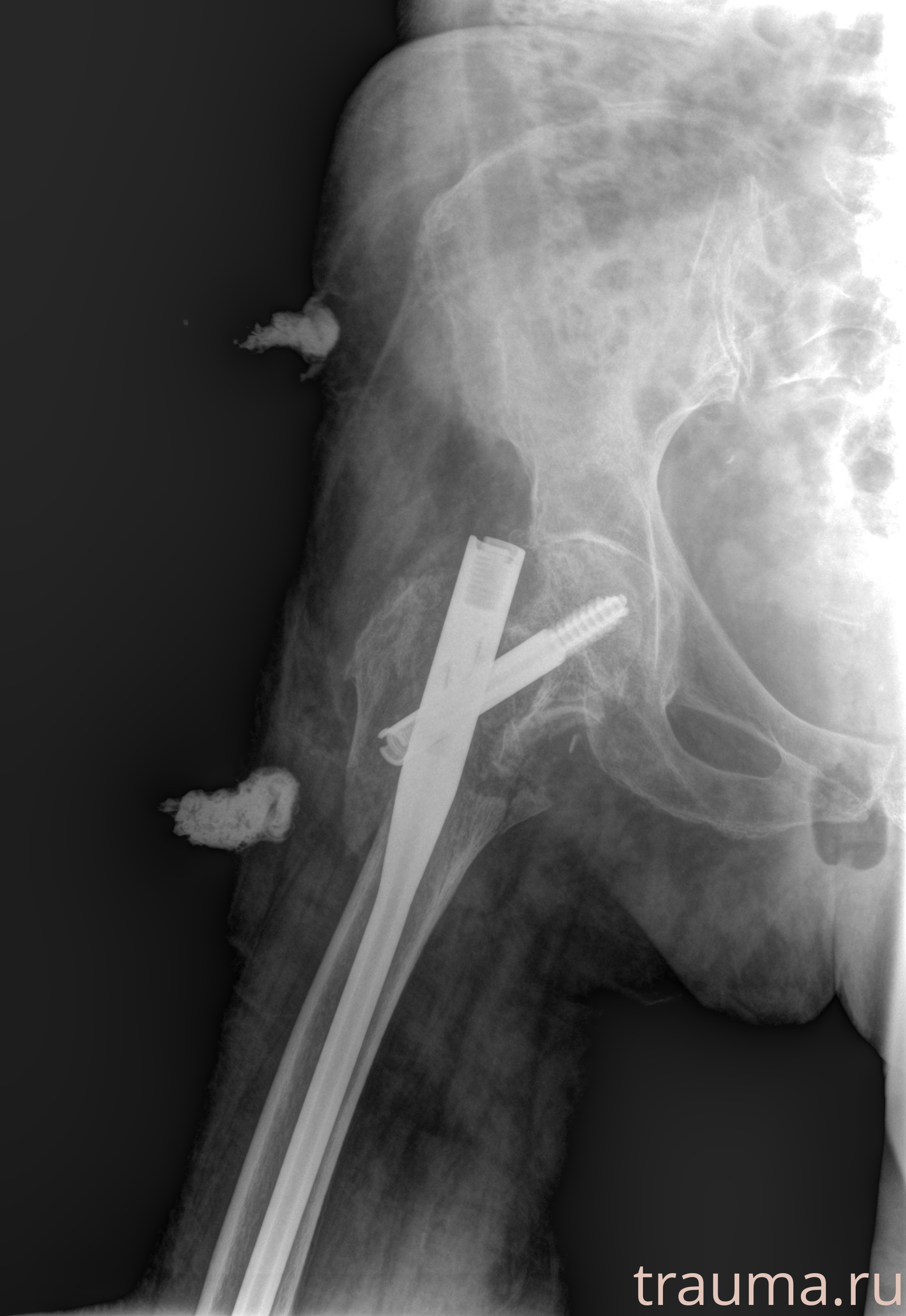 Рентген на дому: по вашему адресу приезжает врач-рентгенолог, травматолог-ортопед с мобильным рентгеновским аппаратом, проводит диагностику травмы или заболевания, делает необходимые рентгенограммы, дает рекомендации по дальнейшему лечению. Получить качественные снимки в домашних условиях возможно благодаря уникальной методике, разработанной МосРентген Центром для института  Склифосовского