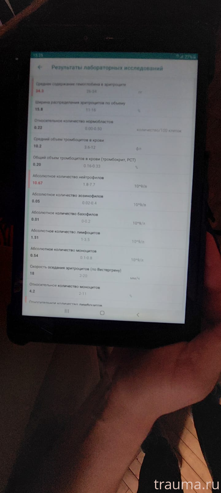 Рентген на дому: по вашему адресу приезжает врач-рентгенолог, травматолог-ортопед с мобильным рентгеновским аппаратом, проводит диагностику травмы или заболевания, делает необходимые рентгенограммы, дает рекомендации по дальнейшему лечению. Получить качественные снимки в домашних условиях возможно благодаря уникальной методике, разработанной МосРентген Центром для института  Склифосовского