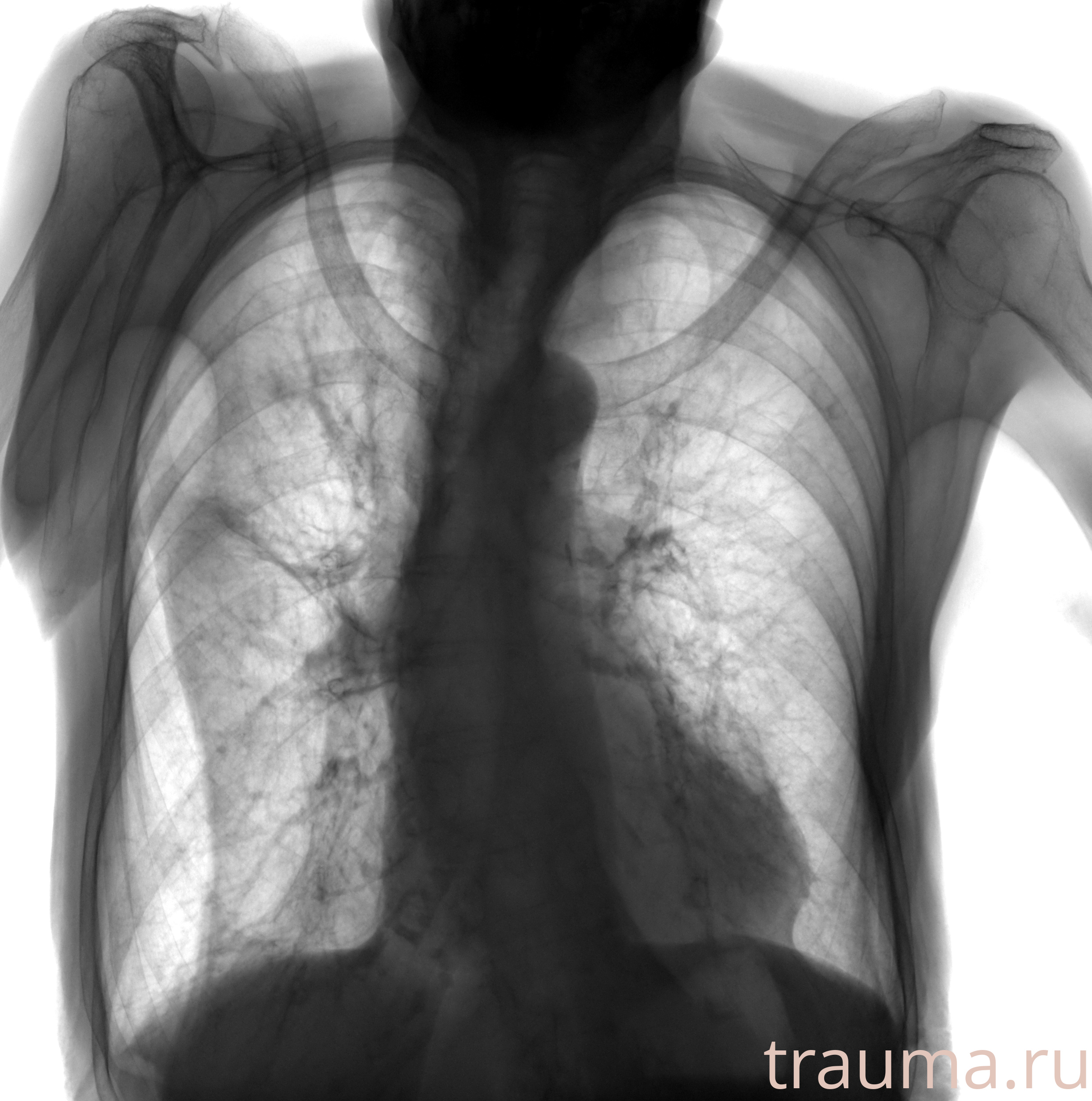 Рентген на дому: по вашему адресу приезжает врач-рентгенолог, травматолог-ортопед с мобильным рентгеновским аппаратом, проводит диагностику травмы или заболевания, делает необходимые рентгенограммы, дает рекомендации по дальнейшему лечению. Получить качественные снимки в домашних условиях возможно благодаря уникальной методике, разработанной МосРентген Центром для института  Склифосовского