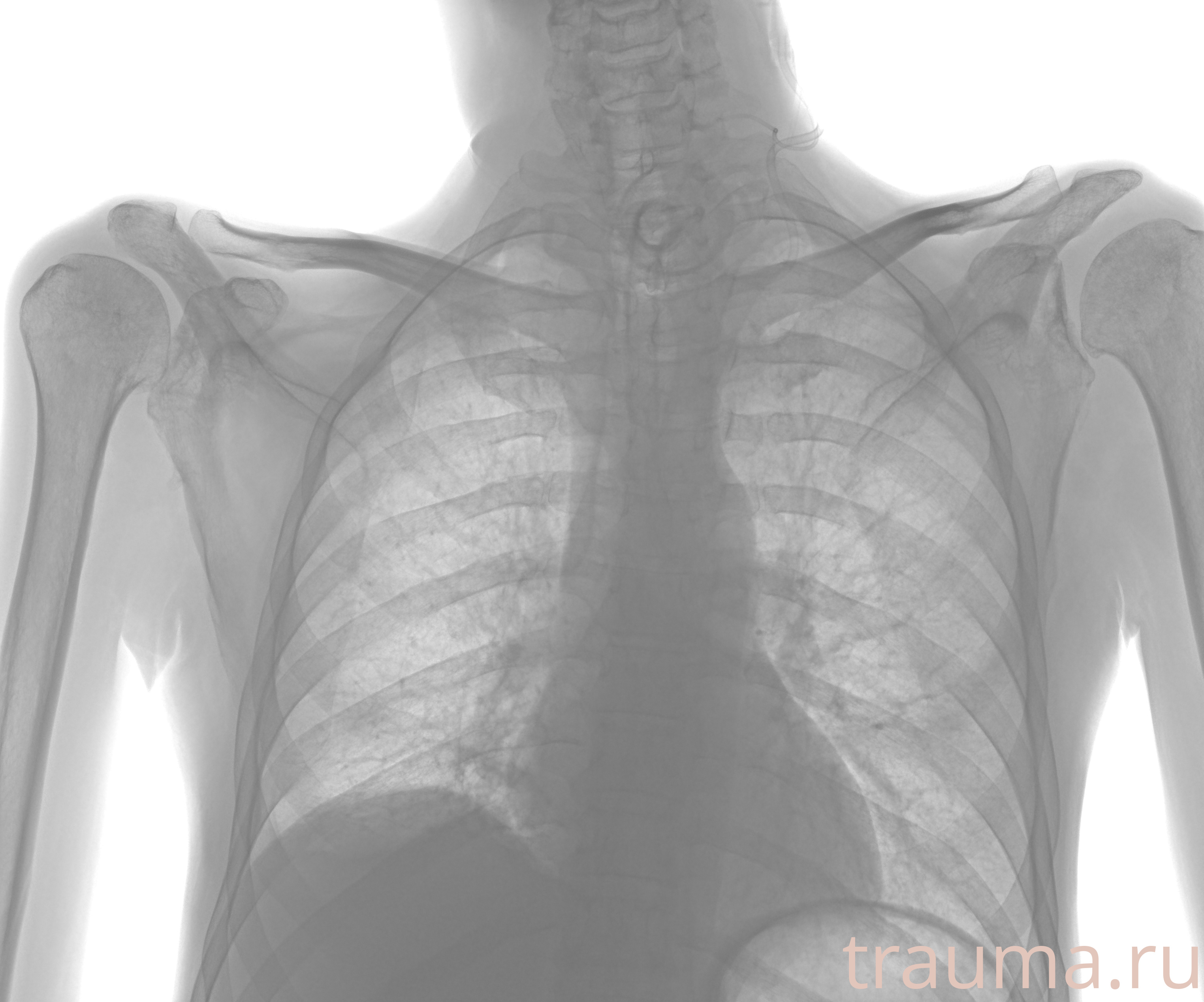 Рентген на дому: по вашему адресу приезжает врач-рентгенолог, травматолог-ортопед с мобильным рентгеновским аппаратом, проводит диагностику травмы или заболевания, делает необходимые рентгенограммы, дает рекомендации по дальнейшему лечению. Получить качественные снимки в домашних условиях возможно благодаря уникальной методике, разработанной МосРентген Центром для института  Склифосовского