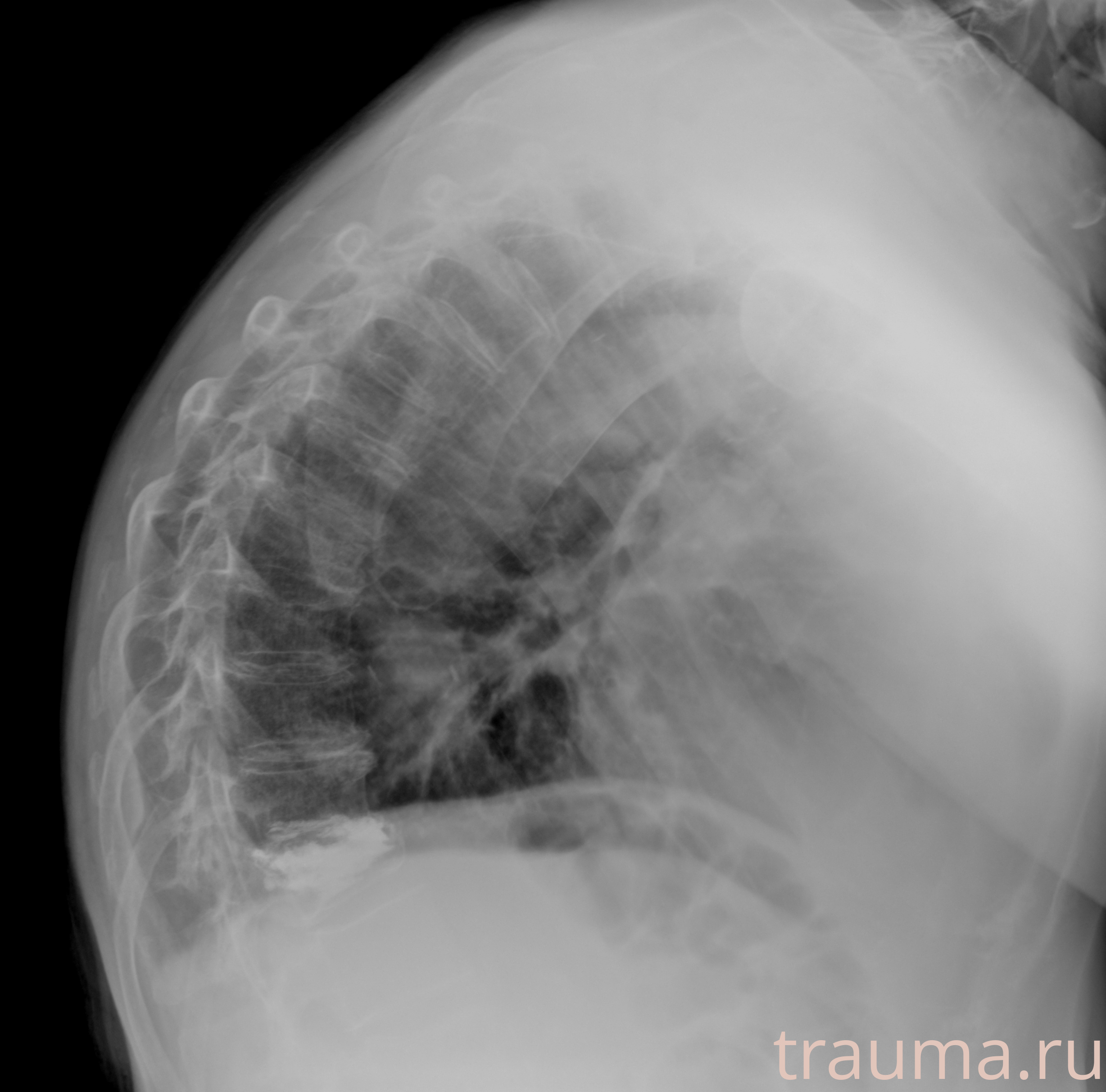 Рентген на дому: по вашему адресу приезжает врач-рентгенолог, травматолог-ортопед с мобильным рентгеновским аппаратом, проводит диагностику травмы или заболевания, делает необходимые рентгенограммы, дает рекомендации по дальнейшему лечению. Получить качественные снимки в домашних условиях возможно благодаря уникальной методике, разработанной МосРентген Центром для института  Склифосовского