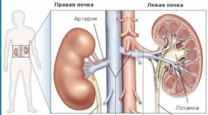 Злокачественные новообразования почек, почечных лоханок, мочеточника, других и неуточненных мочевых органов Злокачественные новообразования почек, почечных лоханок, мочеточника, других и неуточненных мочевых органов