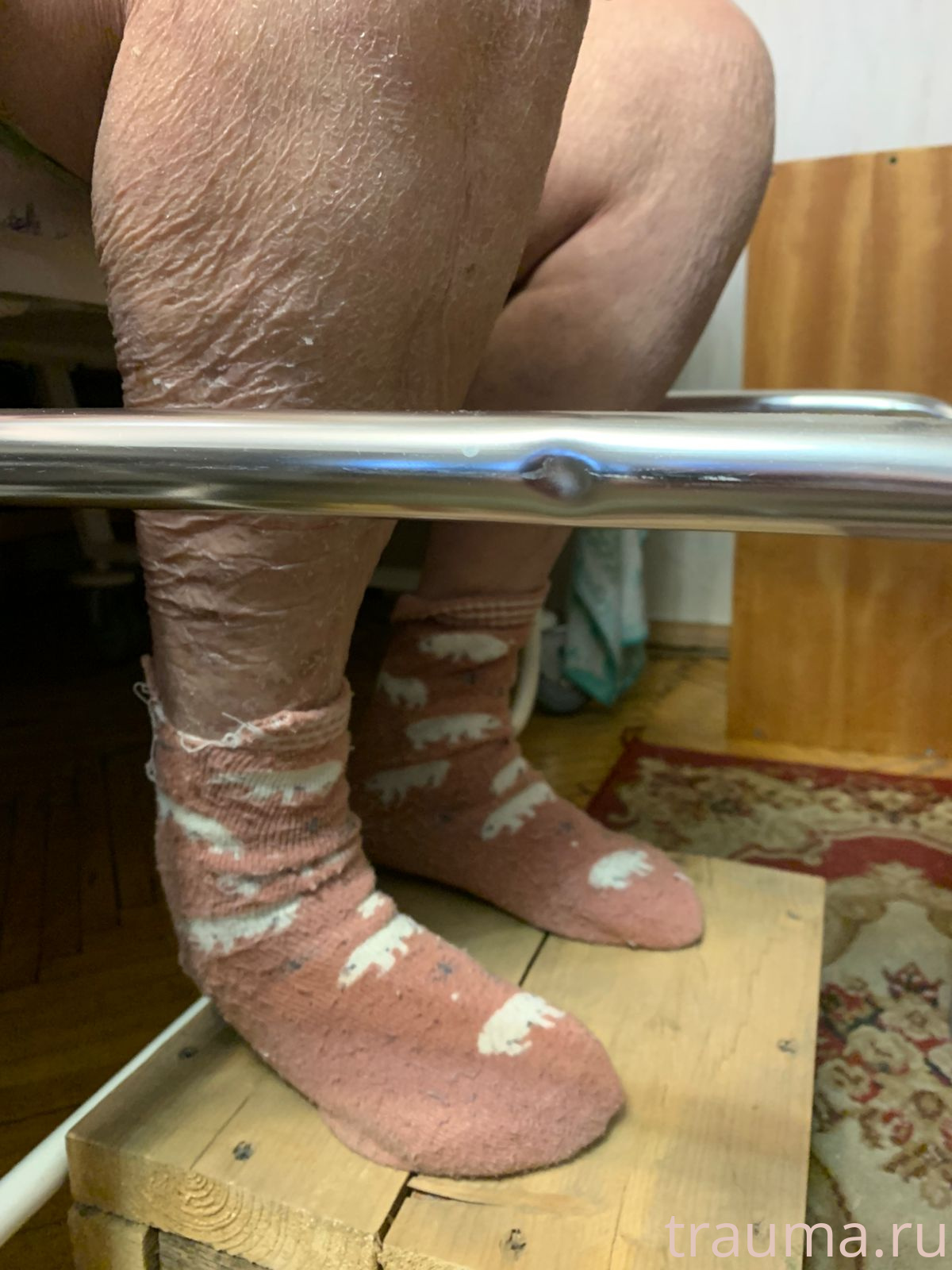 Рентген на дому: по вашему адресу приезжает врач-рентгенолог, травматолог-ортопед с мобильным рентгеновским аппаратом, проводит диагностику травмы или заболевания, делает необходимые рентгенограммы, дает рекомендации по дальнейшему лечению. Получить качественные снимки в домашних условиях возможно благодаря уникальной методике, разработанной МосРентген Центром для института  Склифосовского