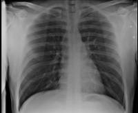 Органы грудной клетки здорового человека в рентгеновском изображении