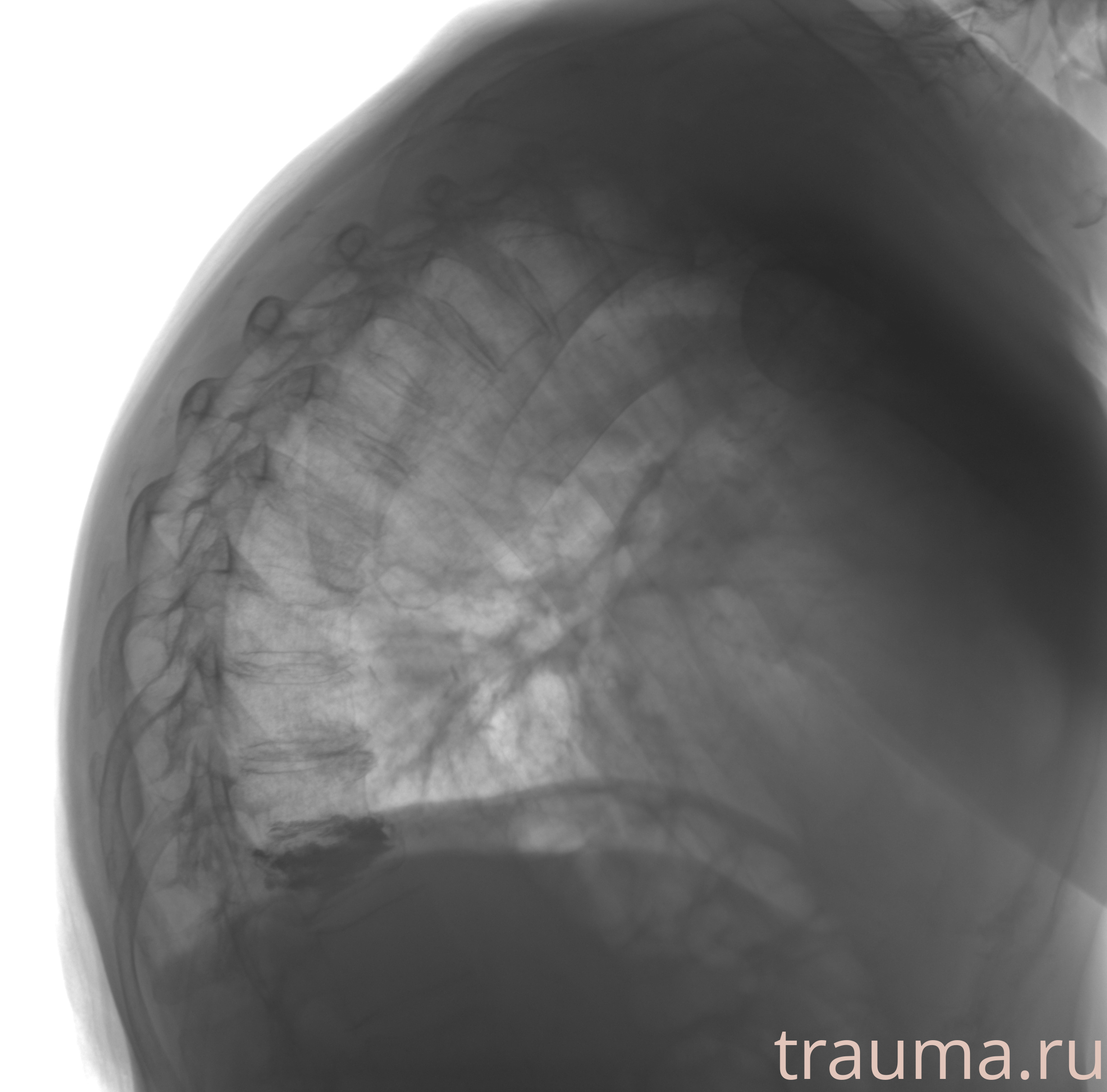 Рентген на дому: по вашему адресу приезжает врач-рентгенолог, травматолог-ортопед с мобильным рентгеновским аппаратом, проводит диагностику травмы или заболевания, делает необходимые рентгенограммы, дает рекомендации по дальнейшему лечению. Получить качественные снимки в домашних условиях возможно благодаря уникальной методике, разработанной МосРентген Центром для института  Склифосовского