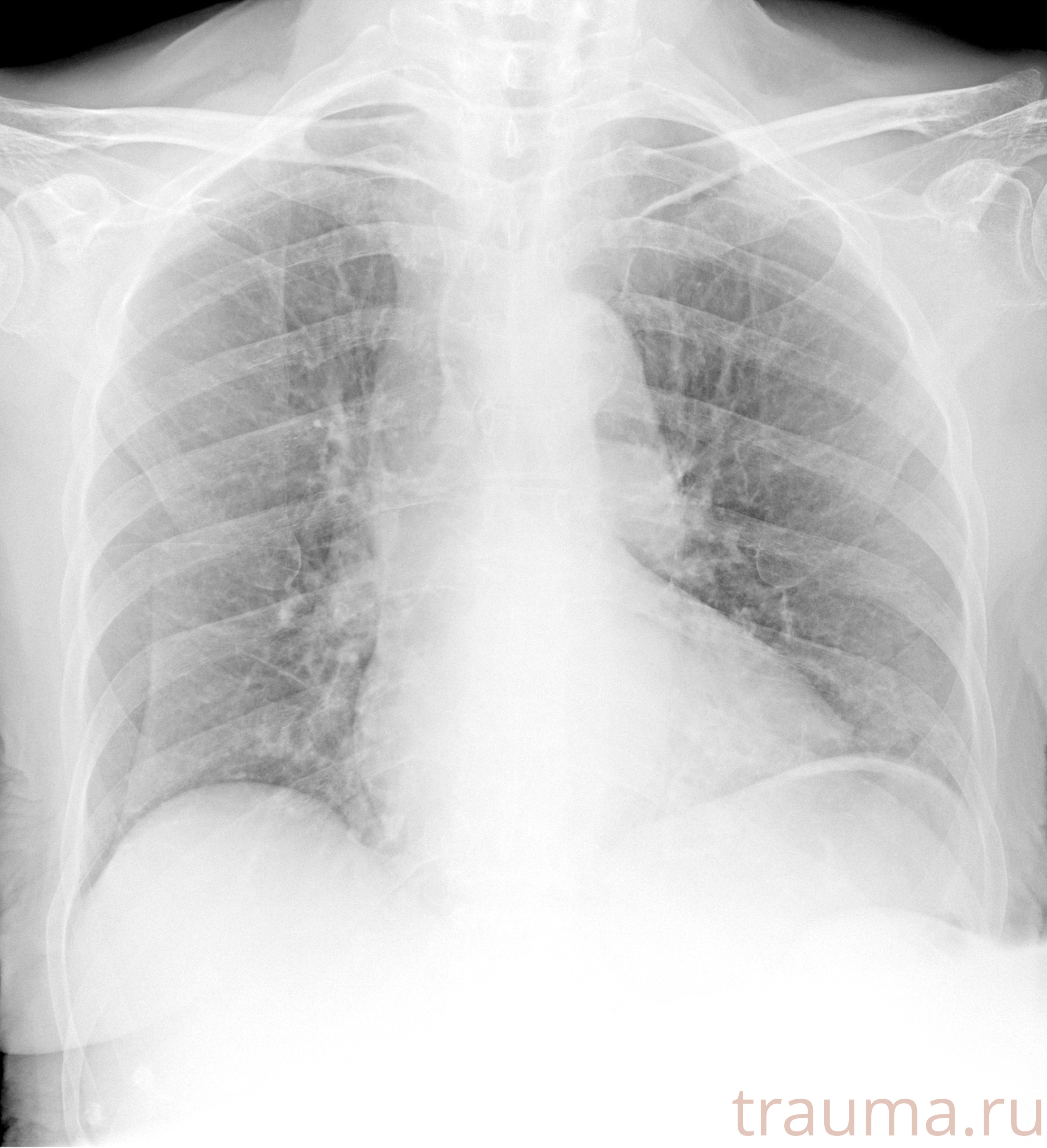 Рентген на дому: по вашему адресу приезжает врач-рентгенолог, травматолог-ортопед с мобильным рентгеновским аппаратом, проводит диагностику травмы или заболевания, делает необходимые рентгенограммы, дает рекомендации по дальнейшему лечению. Получить качественные снимки в домашних условиях возможно благодаря уникальной методике, разработанной МосРентген Центром для института  Склифосовского