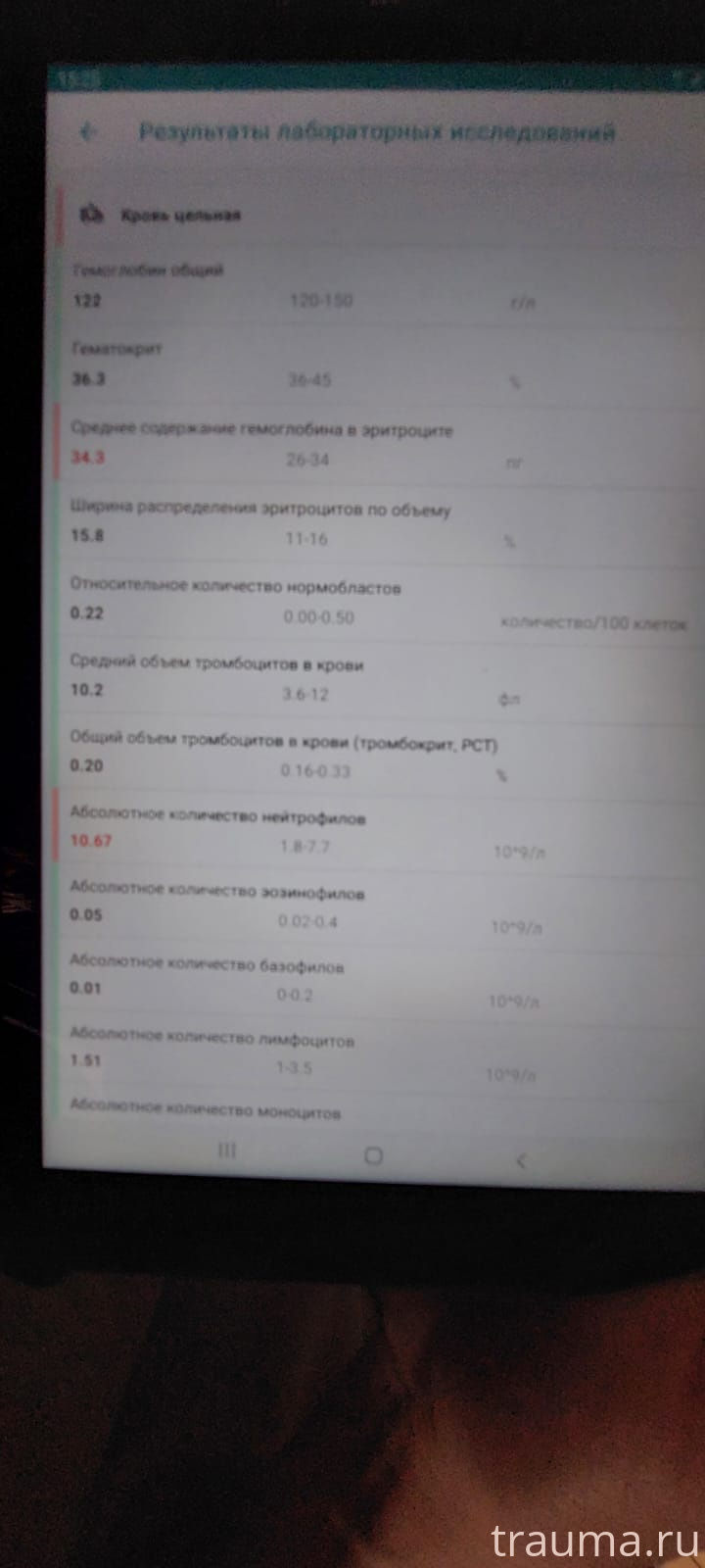 Рентген на дому: по вашему адресу приезжает врач-рентгенолог, травматолог-ортопед с мобильным рентгеновским аппаратом, проводит диагностику травмы или заболевания, делает необходимые рентгенограммы, дает рекомендации по дальнейшему лечению. Получить качественные снимки в домашних условиях возможно благодаря уникальной методике, разработанной МосРентген Центром для института  Склифосовского