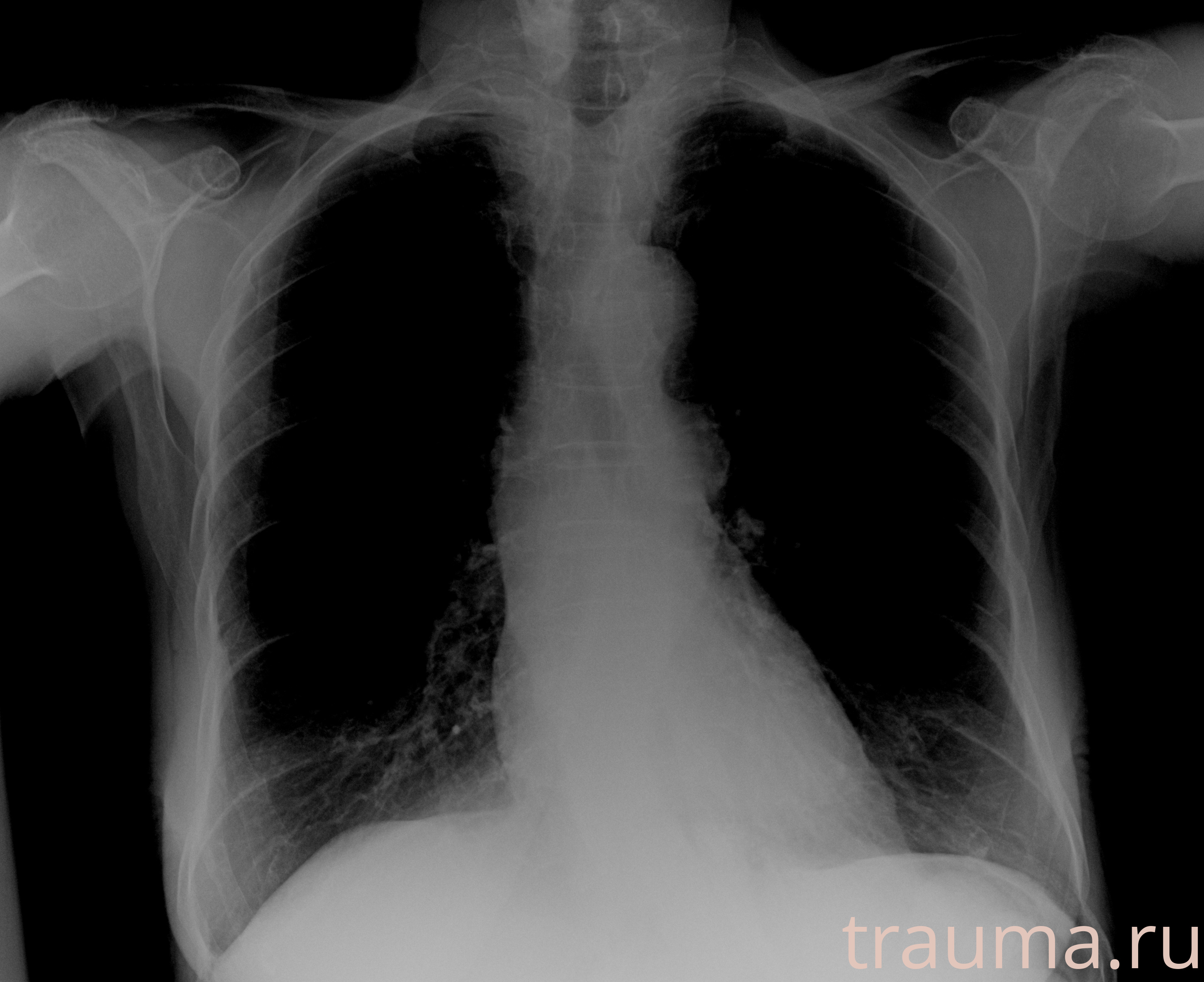 Рентген на дому: по вашему адресу приезжает врач-рентгенолог, травматолог-ортопед с мобильным рентгеновским аппаратом, проводит диагностику травмы или заболевания, делает необходимые рентгенограммы, дает рекомендации по дальнейшему лечению. Получить качественные снимки в домашних условиях возможно благодаря уникальной методике, разработанной МосРентген Центром для института  Склифосовского