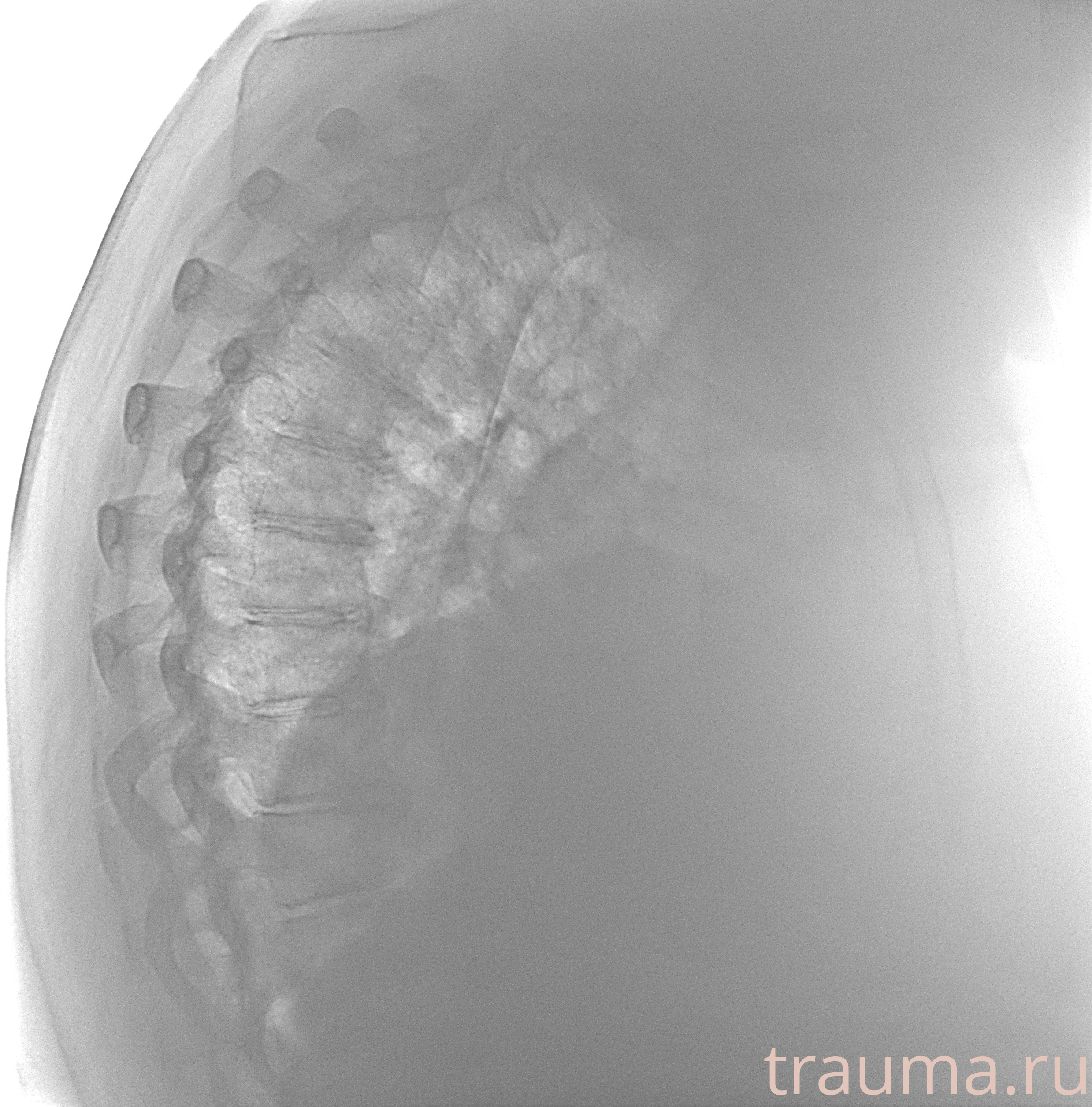 Рентген на дому: по вашему адресу приезжает врач-рентгенолог, травматолог-ортопед с мобильным рентгеновским аппаратом, проводит диагностику травмы или заболевания, делает необходимые рентгенограммы, дает рекомендации по дальнейшему лечению. Получить качественные снимки в домашних условиях возможно благодаря уникальной методике, разработанной МосРентген Центром для института  Склифосовского