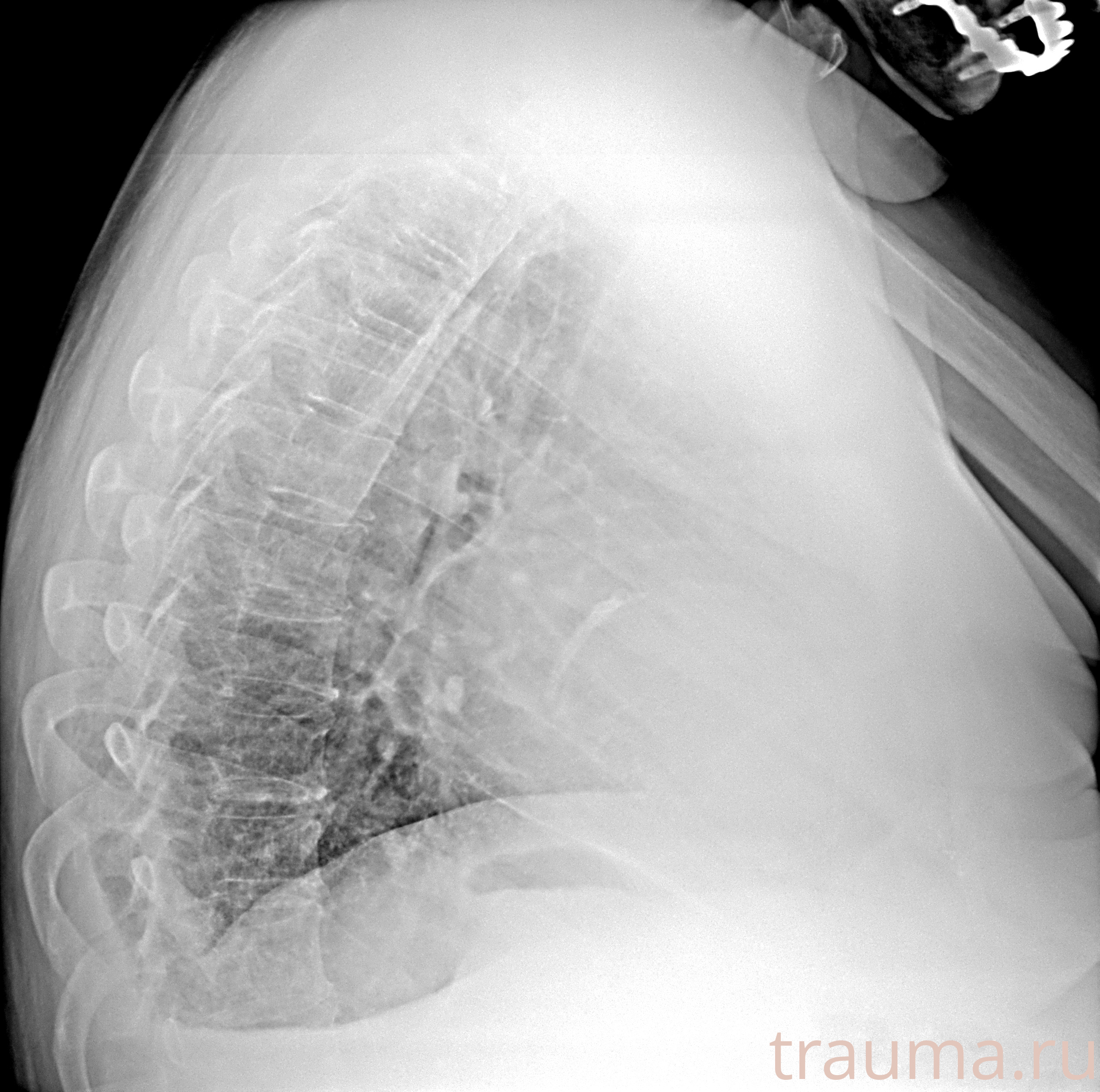 Рентген на дому: по вашему адресу приезжает врач-рентгенолог, травматолог-ортопед с мобильным рентгеновским аппаратом, проводит диагностику травмы или заболевания, делает необходимые рентгенограммы, дает рекомендации по дальнейшему лечению. Получить качественные снимки в домашних условиях возможно благодаря уникальной методике, разработанной МосРентген Центром для института  Склифосовского