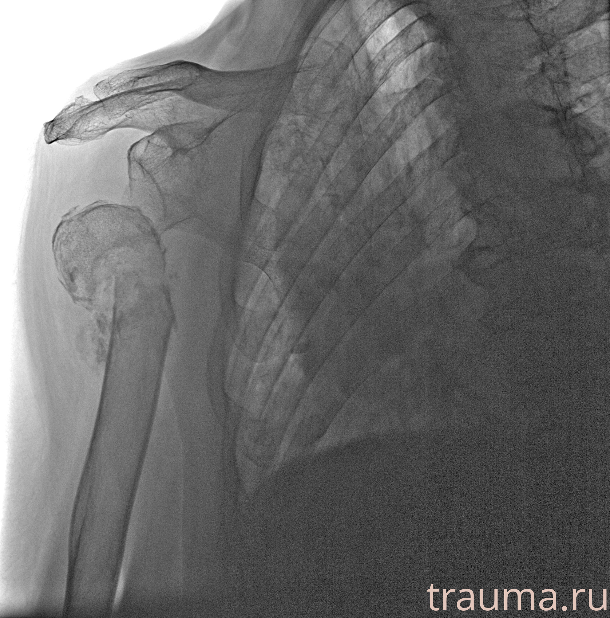 Рентген на дому: по вашему адресу приезжает врач-рентгенолог, травматолог-ортопед с мобильным рентгеновским аппаратом, проводит диагностику травмы или заболевания, делает необходимые рентгенограммы, дает рекомендации по дальнейшему лечению. Получить качественные снимки в домашних условиях возможно благодаря уникальной методике, разработанной МосРентген Центром для института  Склифосовского