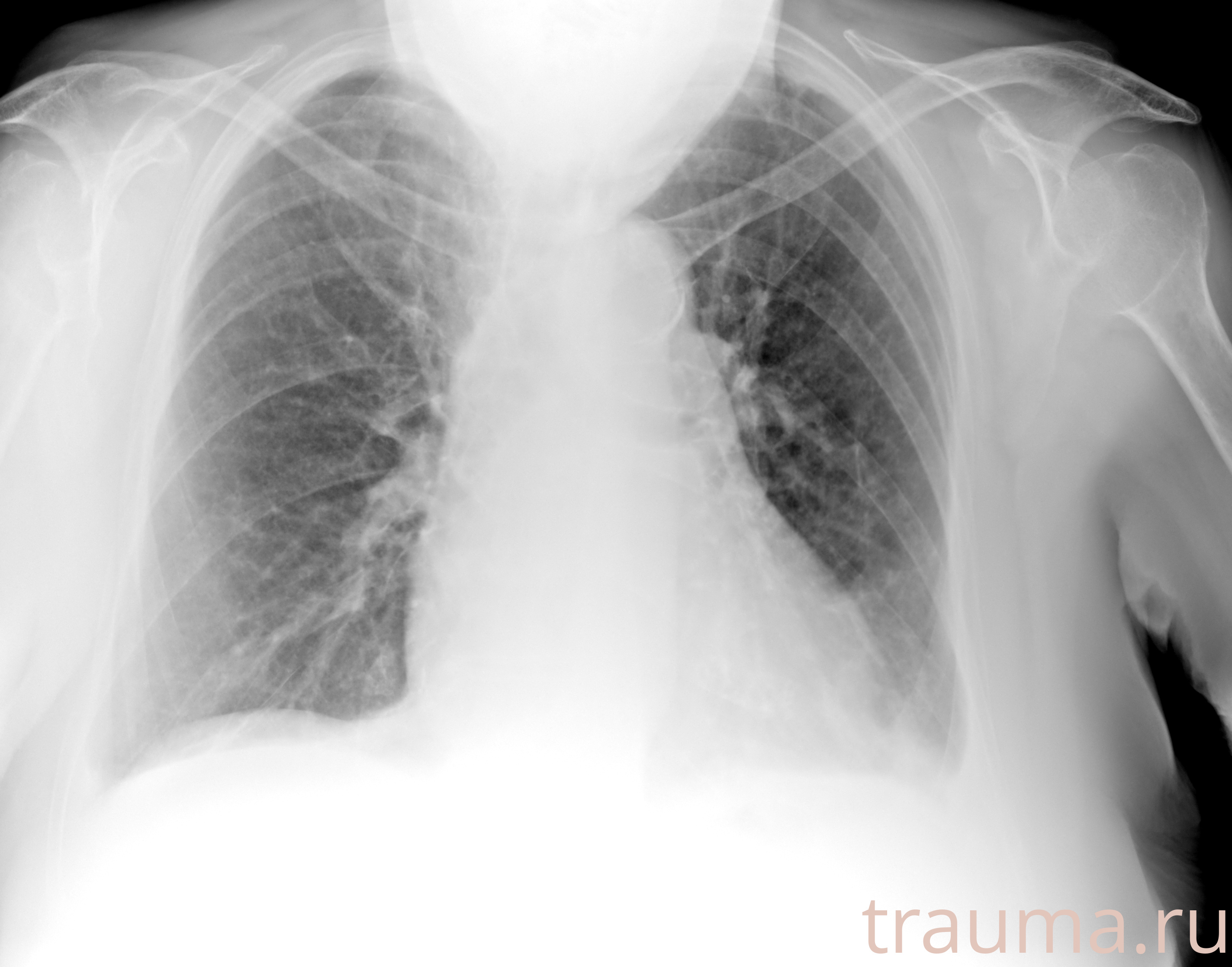 Рентген на дому: по вашему адресу приезжает врач-рентгенолог, травматолог-ортопед с мобильным рентгеновским аппаратом, проводит диагностику травмы или заболевания, делает необходимые рентгенограммы, дает рекомендации по дальнейшему лечению. Получить качественные снимки в домашних условиях возможно благодаря уникальной методике, разработанной МосРентген Центром для института  Склифосовского