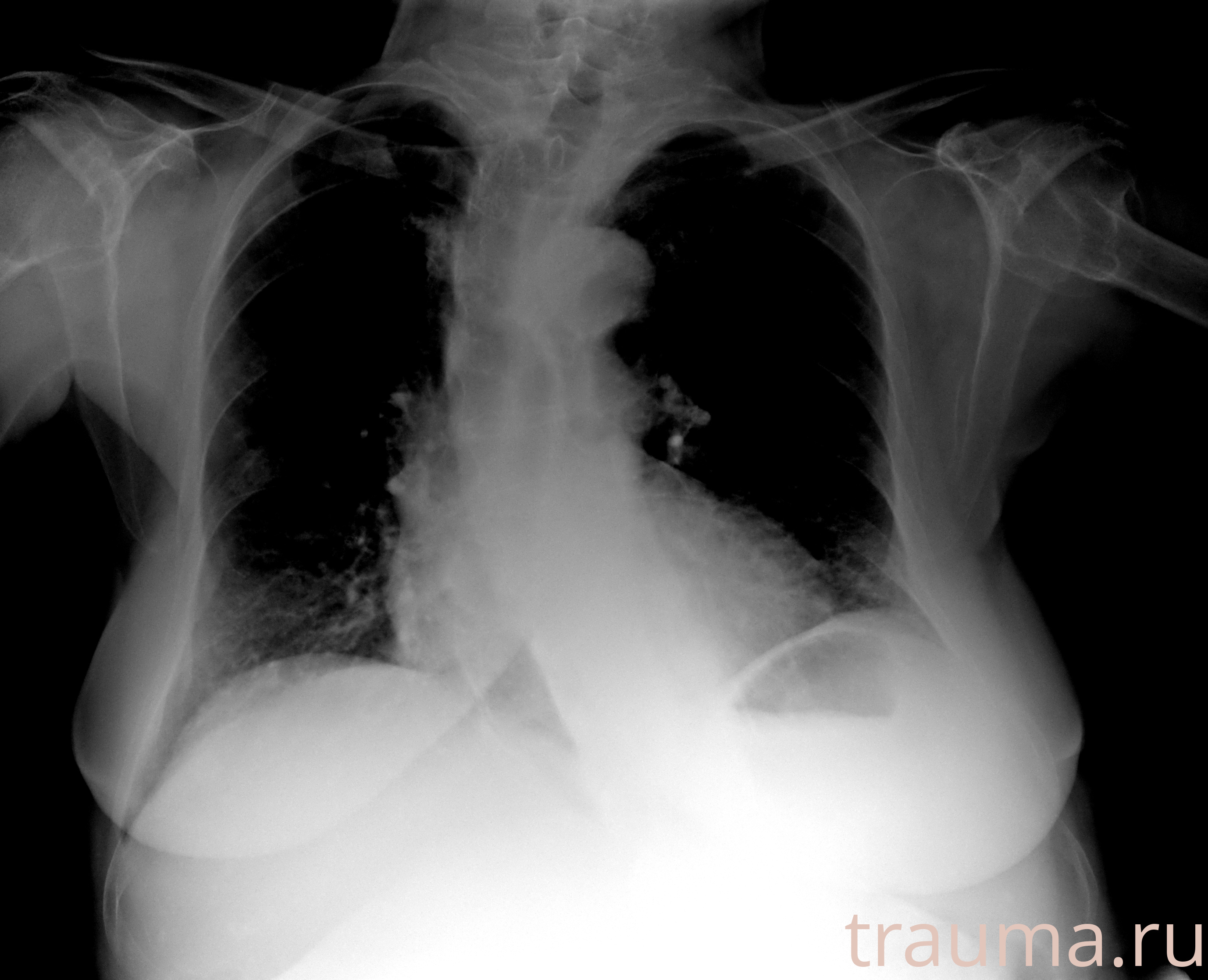 Рентген на дому: по вашему адресу приезжает врач-рентгенолог, травматолог-ортопед с мобильным рентгеновским аппаратом, проводит диагностику травмы или заболевания, делает необходимые рентгенограммы, дает рекомендации по дальнейшему лечению. Получить качественные снимки в домашних условиях возможно благодаря уникальной методике, разработанной МосРентген Центром для института  Склифосовского