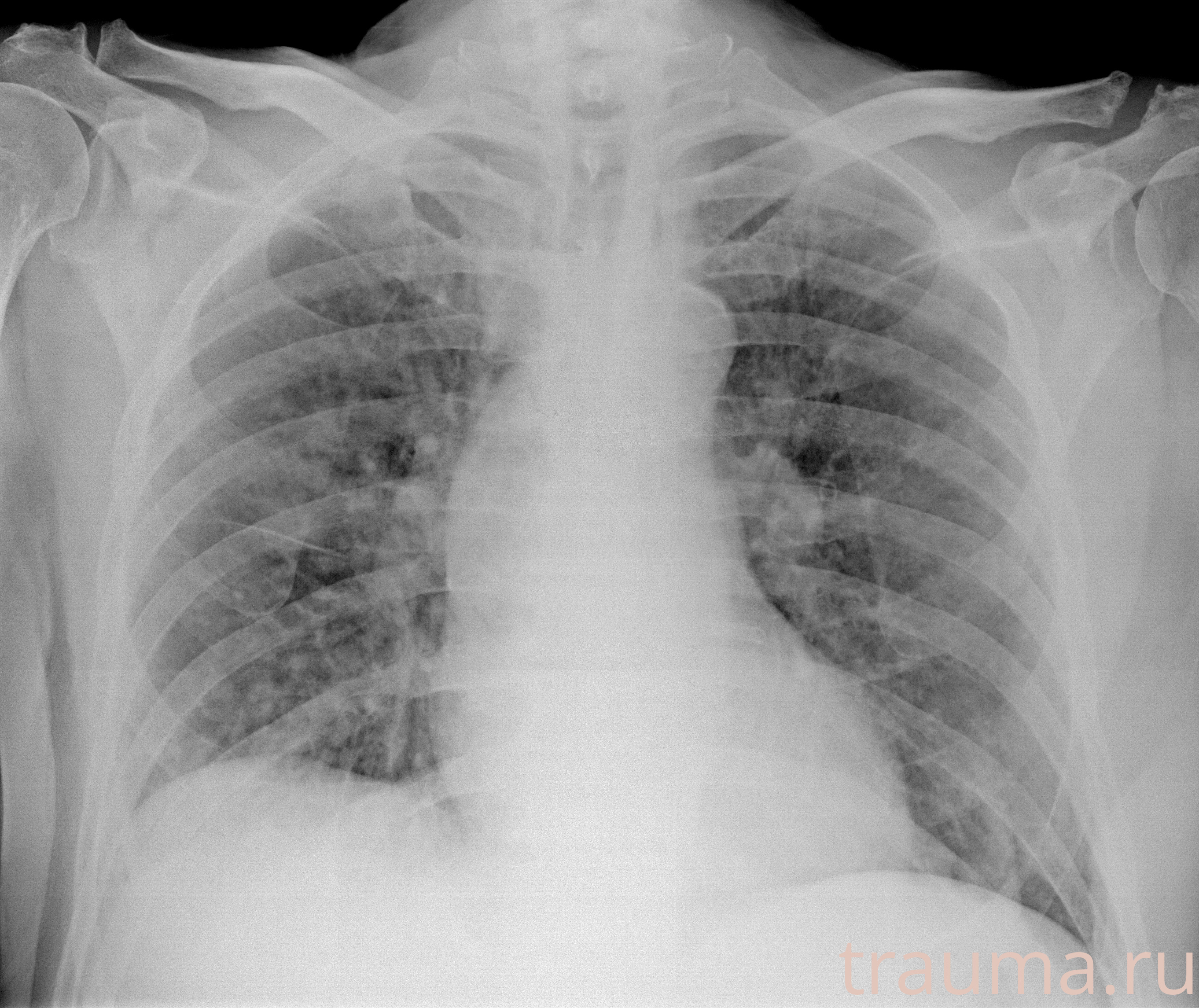 Рентген на дому: по вашему адресу приезжает врач-рентгенолог, травматолог-ортопед с мобильным рентгеновским аппаратом, проводит диагностику травмы или заболевания, делает необходимые рентгенограммы, дает рекомендации по дальнейшему лечению. Получить качественные снимки в домашних условиях возможно благодаря уникальной методике, разработанной МосРентген Центром для института  Склифосовского