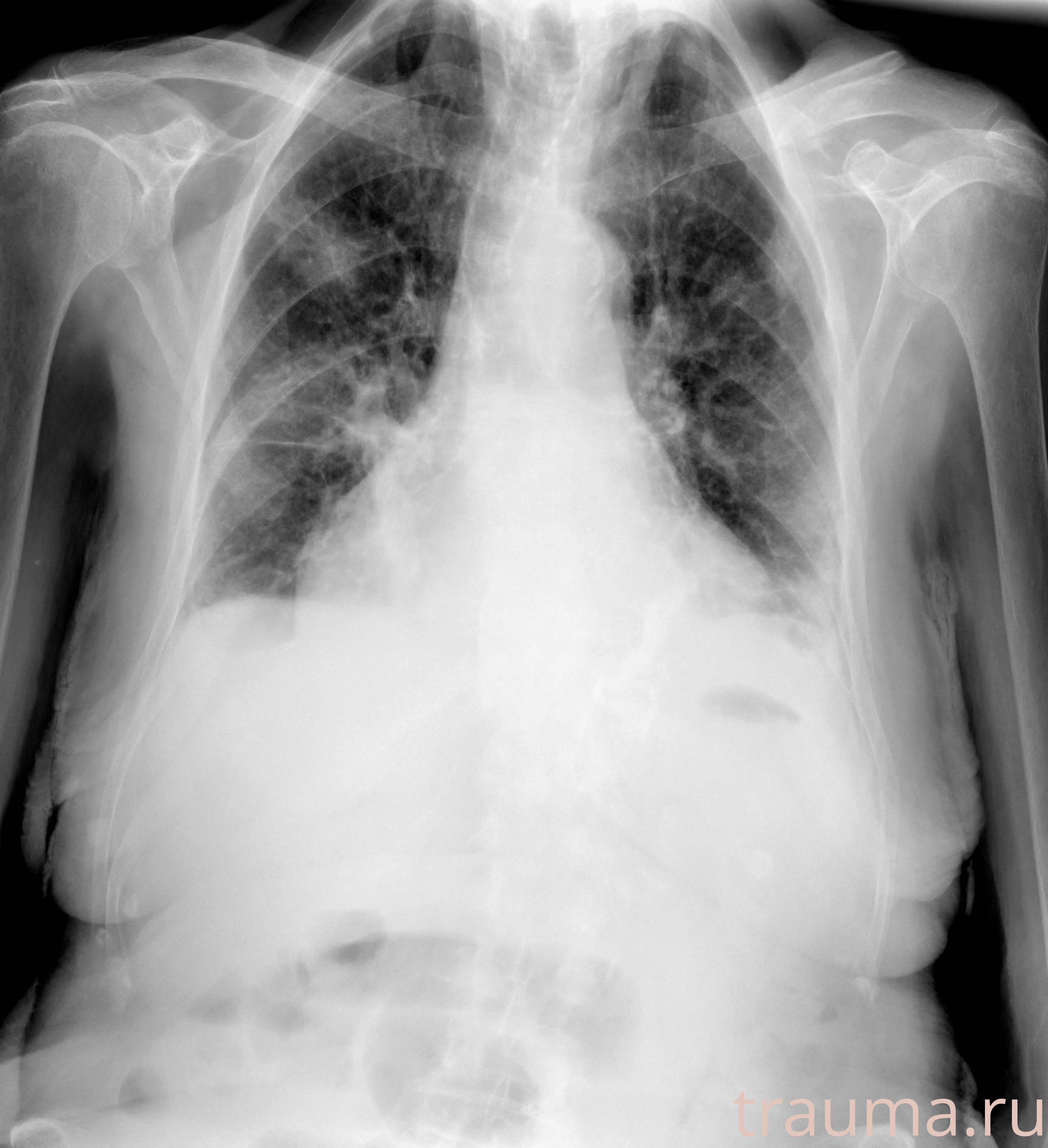 Рентген на дому: по вашему адресу приезжает врач-рентгенолог, травматолог-ортопед с мобильным рентгеновским аппаратом, проводит диагностику травмы или заболевания, делает необходимые рентгенограммы, дает рекомендации по дальнейшему лечению. Получить качественные снимки в домашних условиях возможно благодаря уникальной методике, разработанной МосРентген Центром для института  Склифосовского