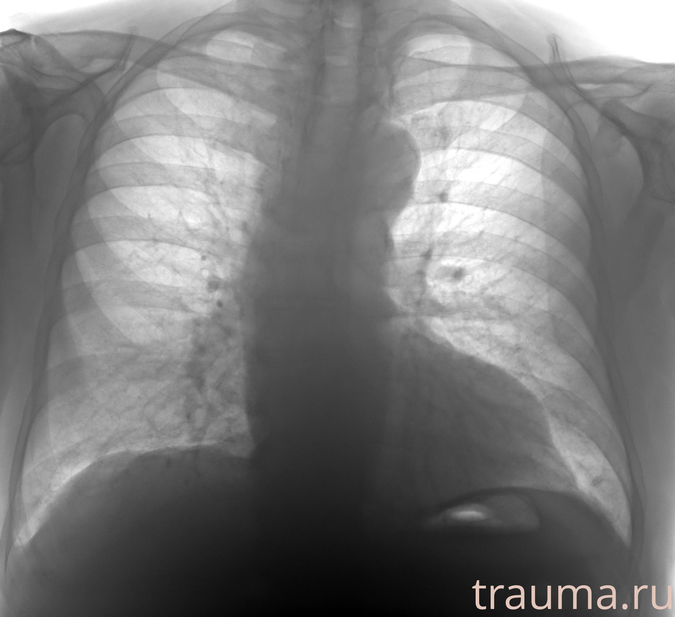 Рентген на дому: по вашему адресу приезжает врач-рентгенолог, травматолог-ортопед с мобильным рентгеновским аппаратом, проводит диагностику травмы или заболевания, делает необходимые рентгенограммы, дает рекомендации по дальнейшему лечению. Получить качественные снимки в домашних условиях возможно благодаря уникальной методике, разработанной МосРентген Центром для института  Склифосовского